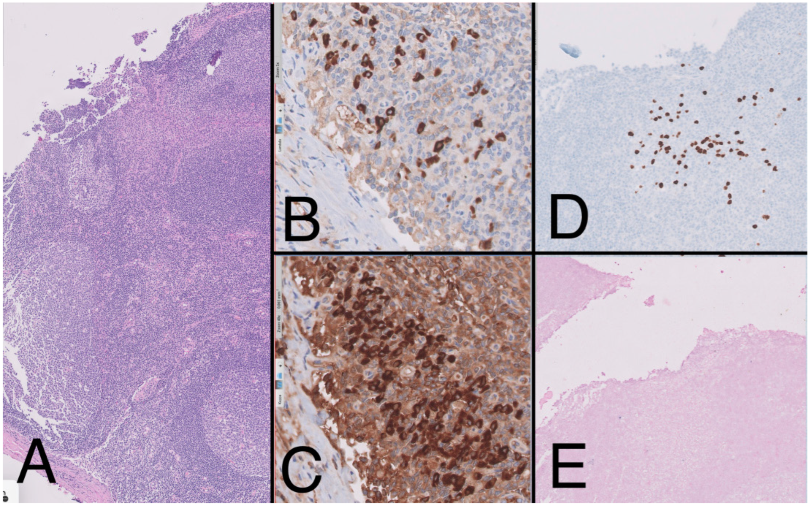 Medicina 59 01049 g004 Medicina 59 01049 g004