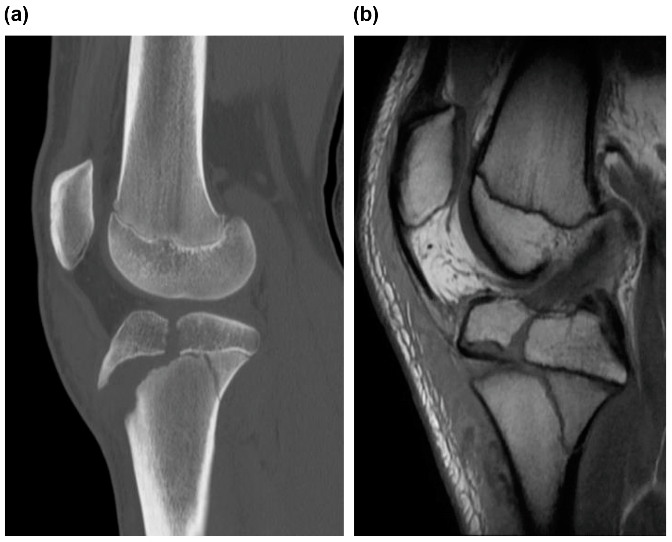 Medicina 59 01061 g002 Medicina 59 01061 g002