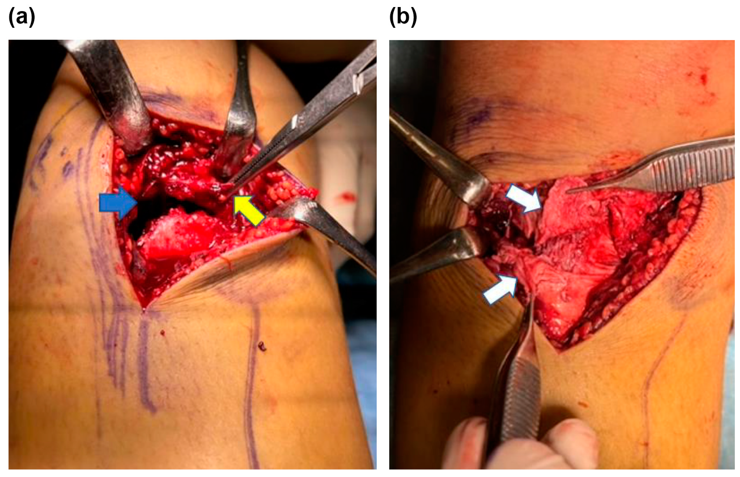 Medicina 59 01061 g003 Medicina 59 01061 g003