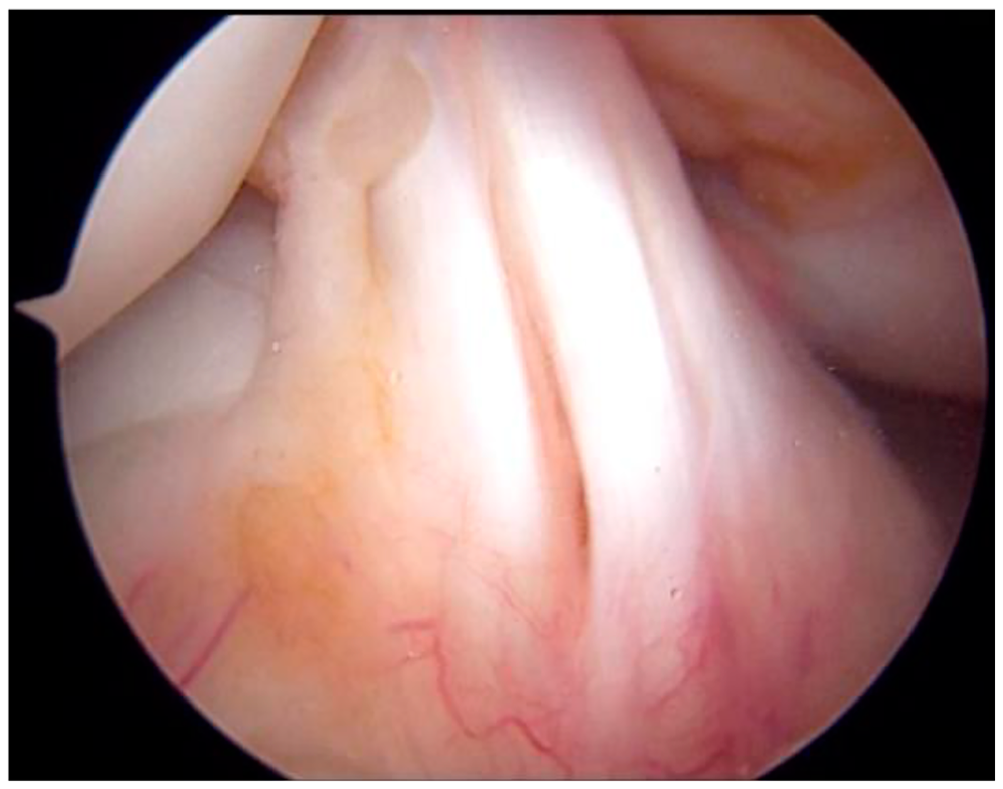 Medicina 59 01061 g006 Medicina 59 01061 g006