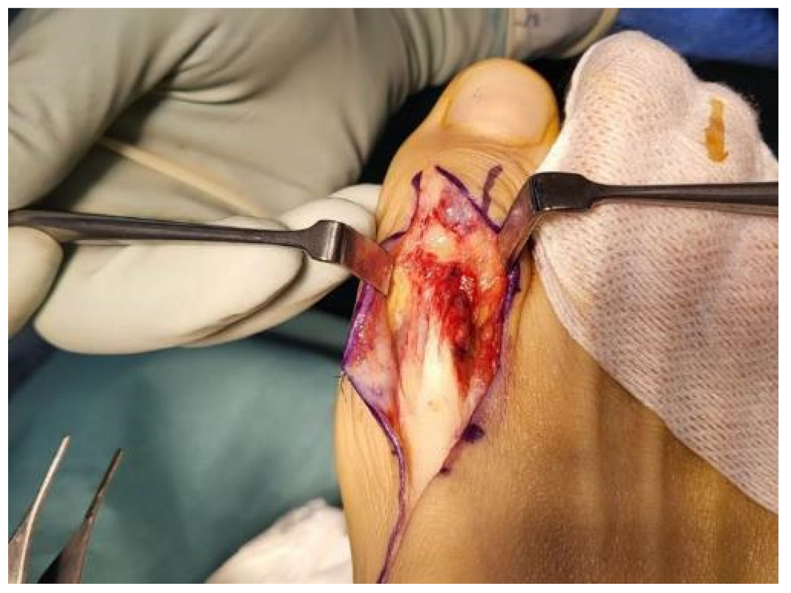 Medicina 59 01069 g003 Medicina 59 01069 g003