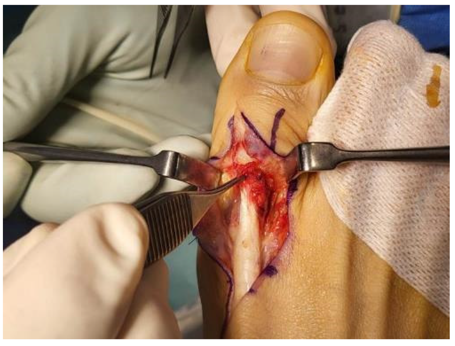 Medicina 59 01069 g004 Medicina 59 01069 g004