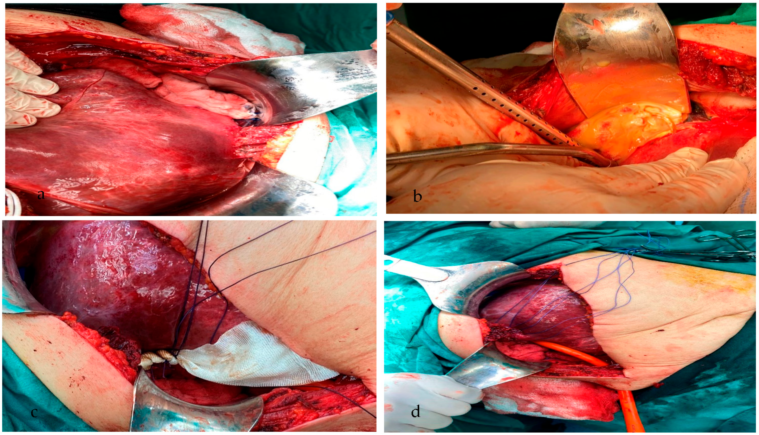 Medicina 59 01070 g002