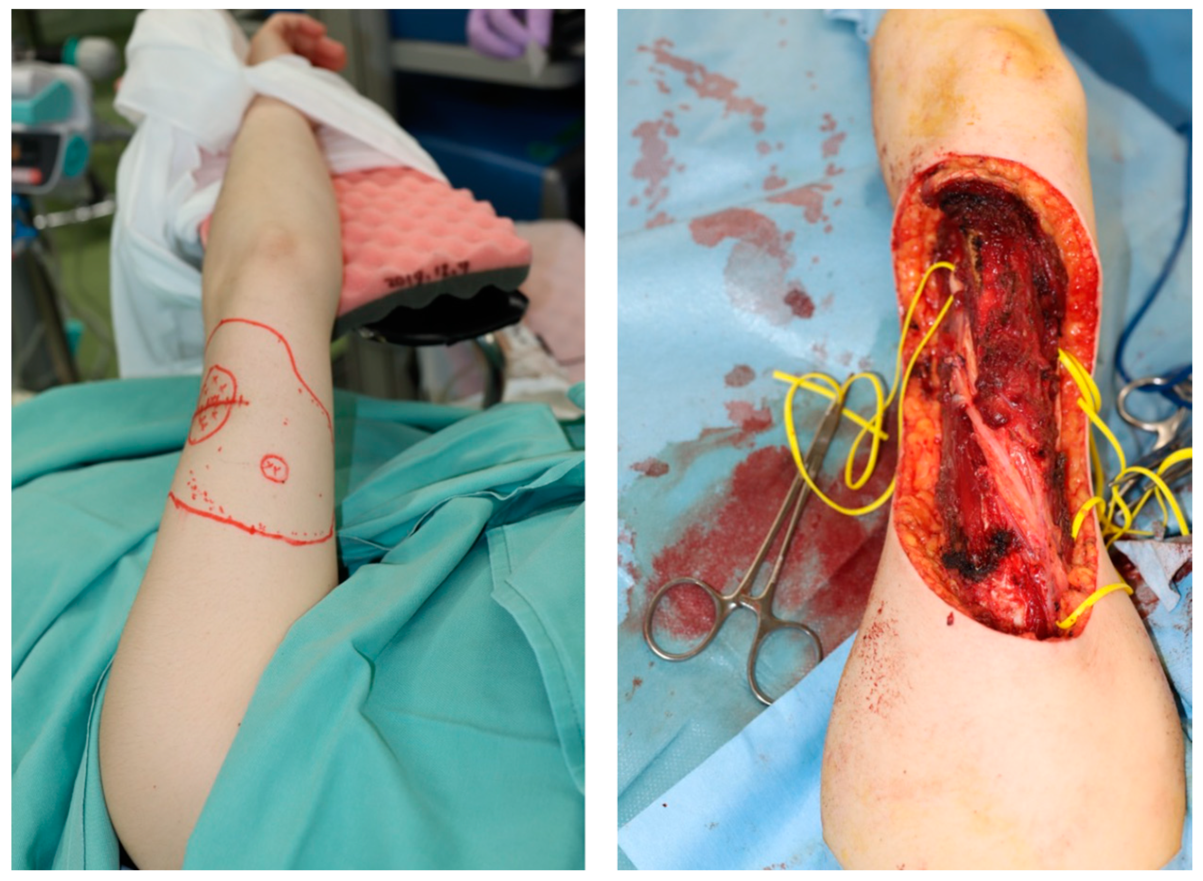 Medicina 59 01087 g003