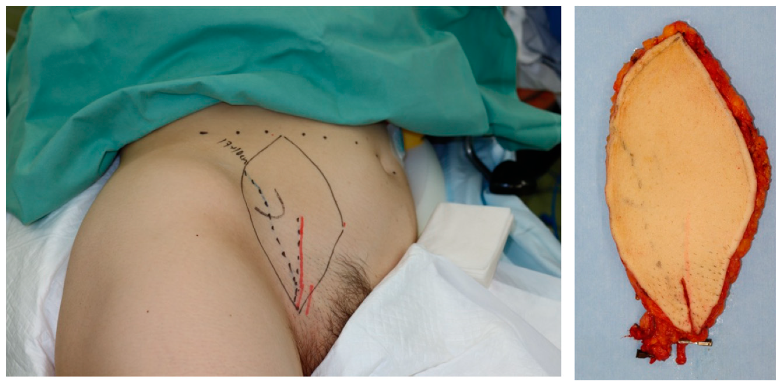 Medicina 59 01087 g004