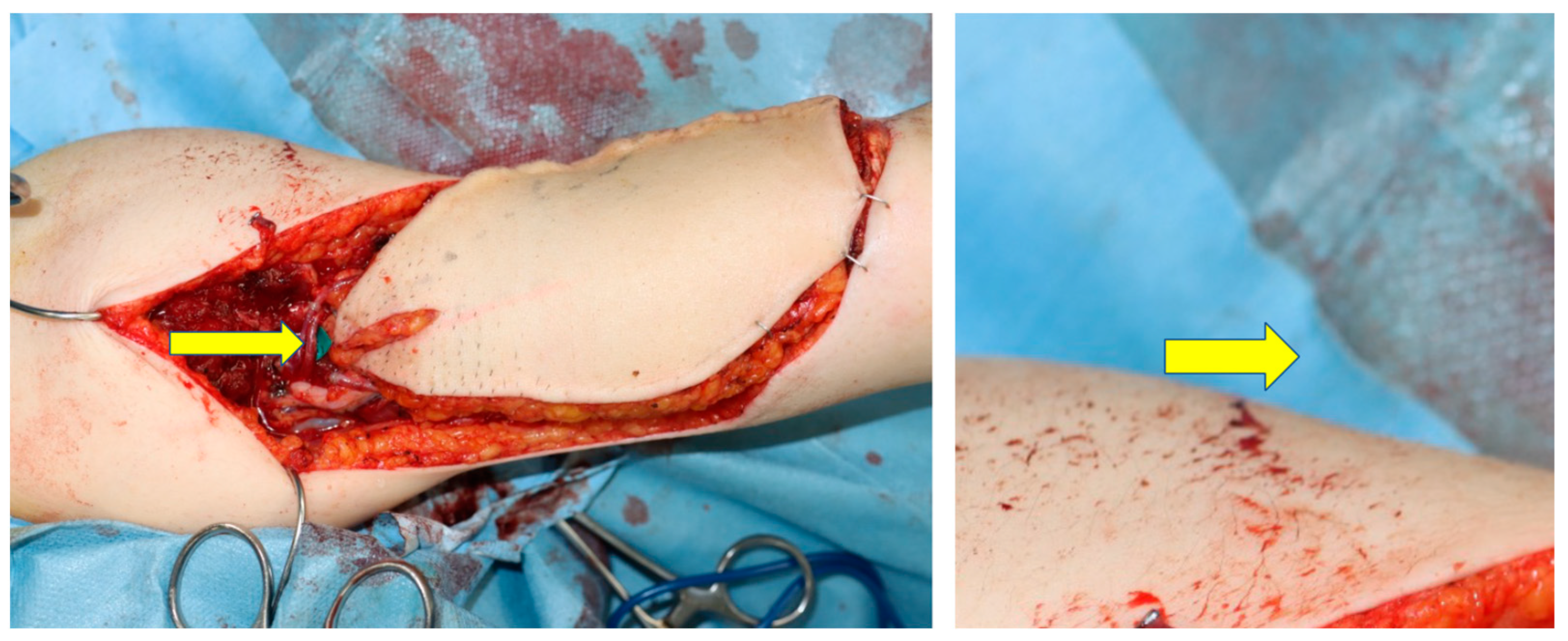 Medicina 59 01087 g005