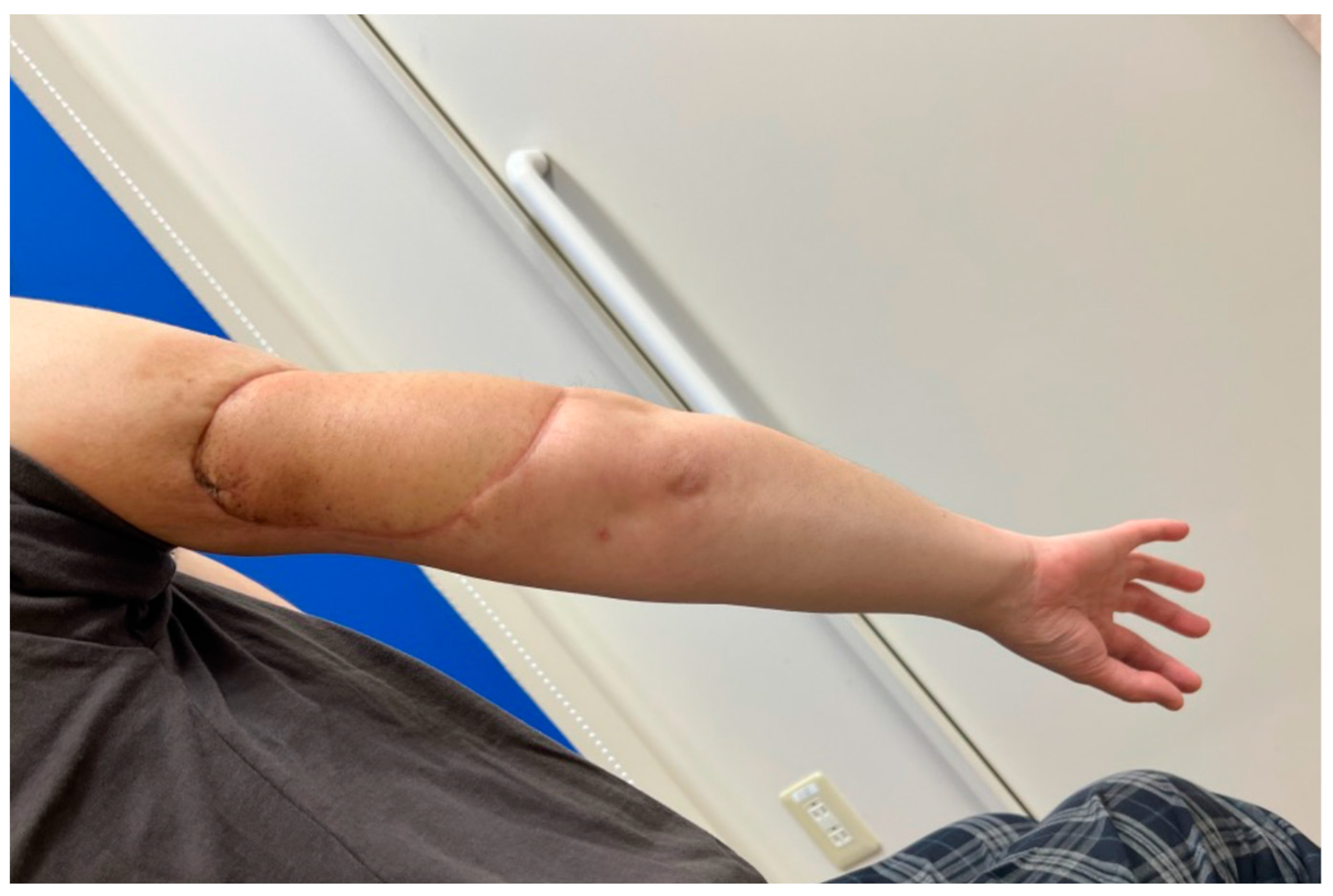 Medicina 59 01087 g006