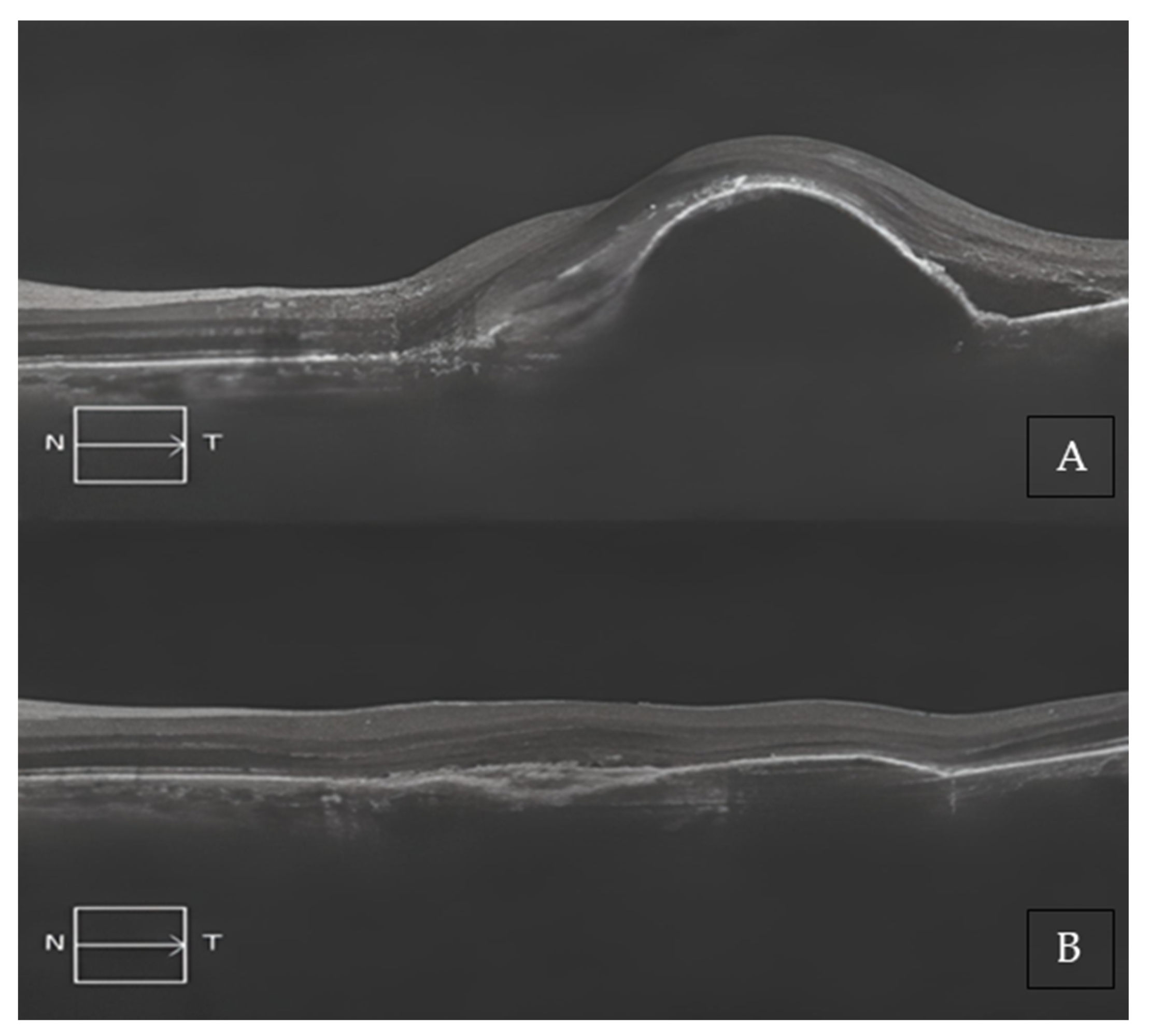 Medicina 59 01110 g003 550