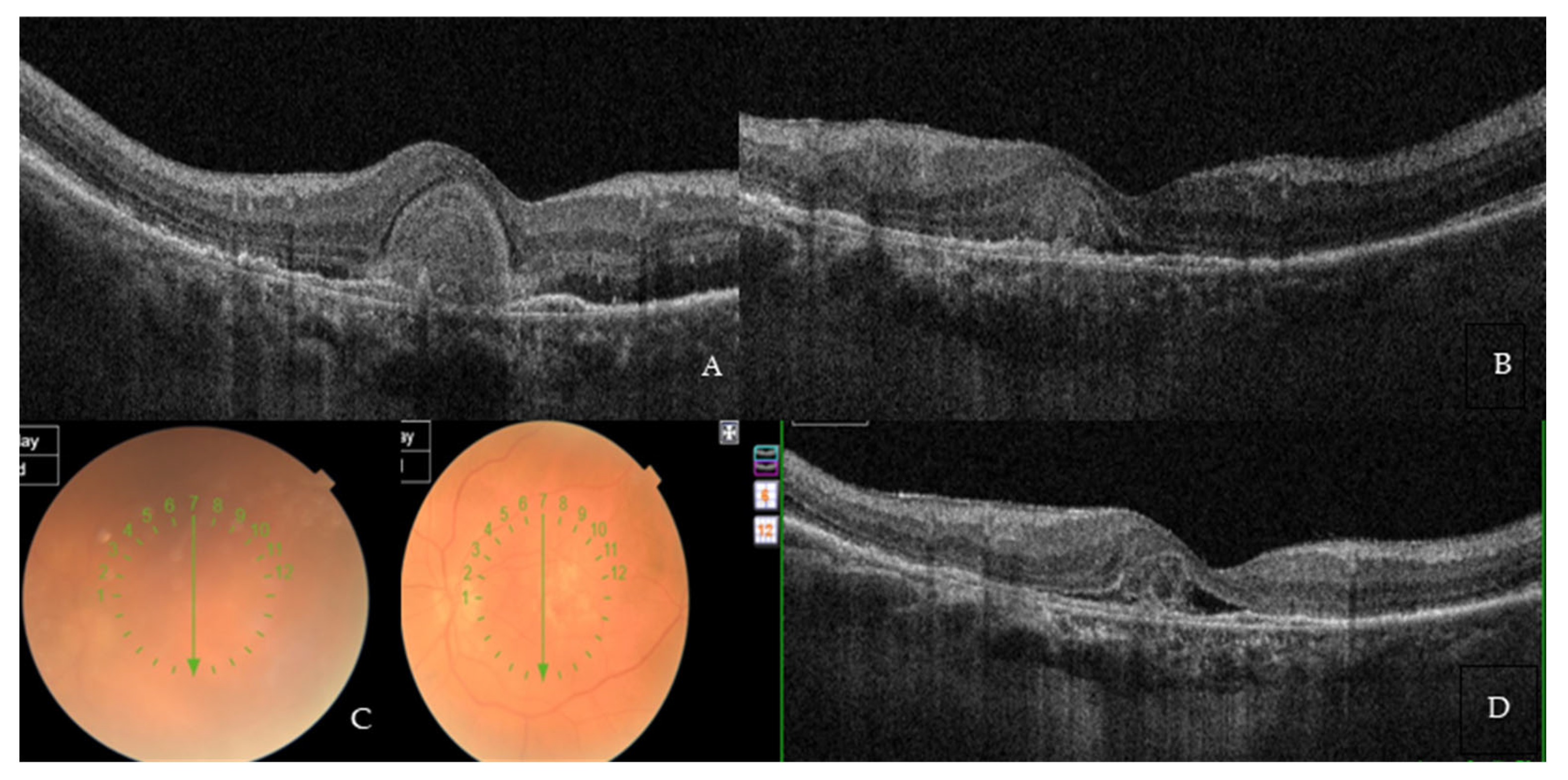Medicina 59 01110 g004 550