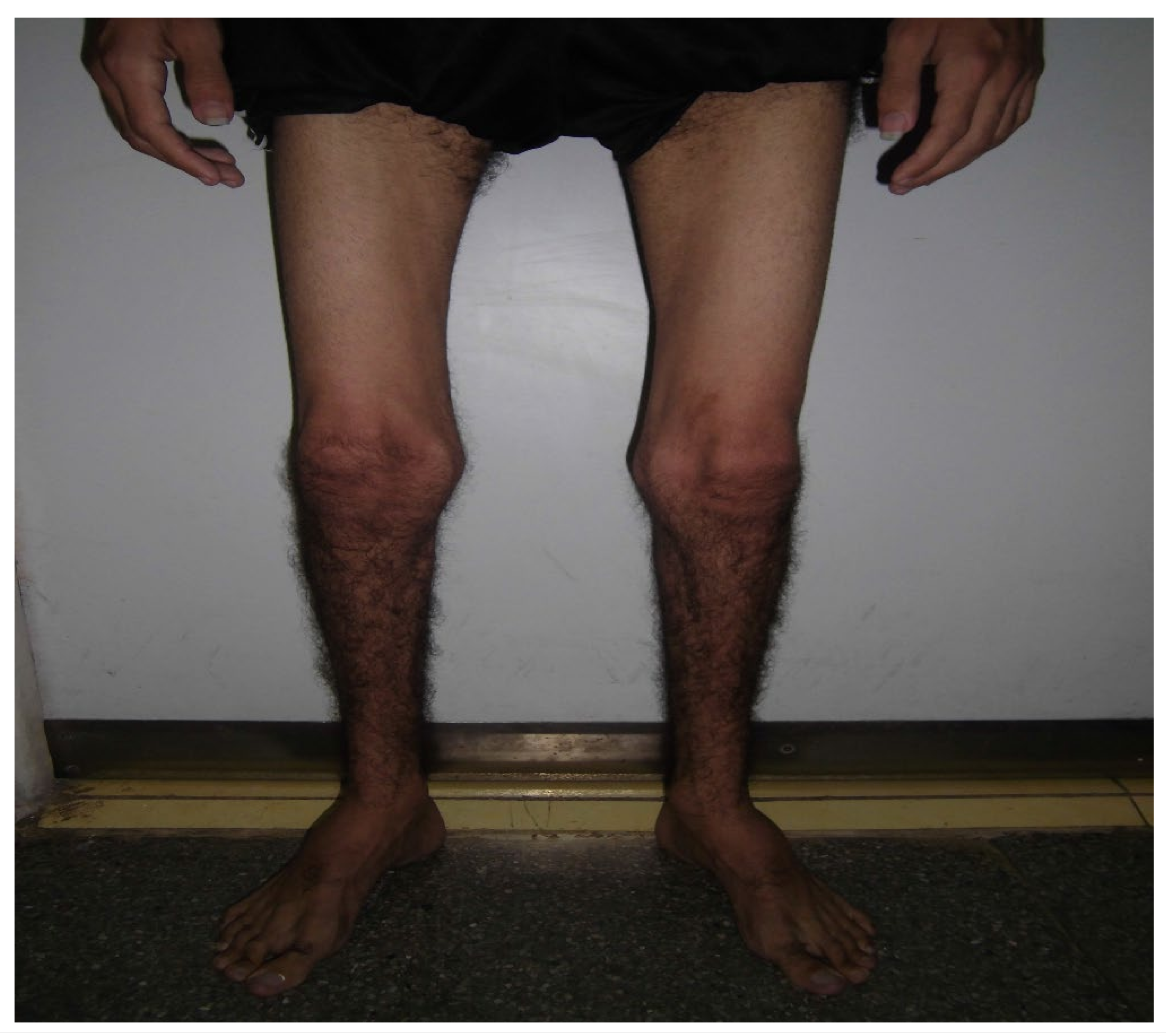 Medicina 59 01112 g001 Medicina 59 01112 g001