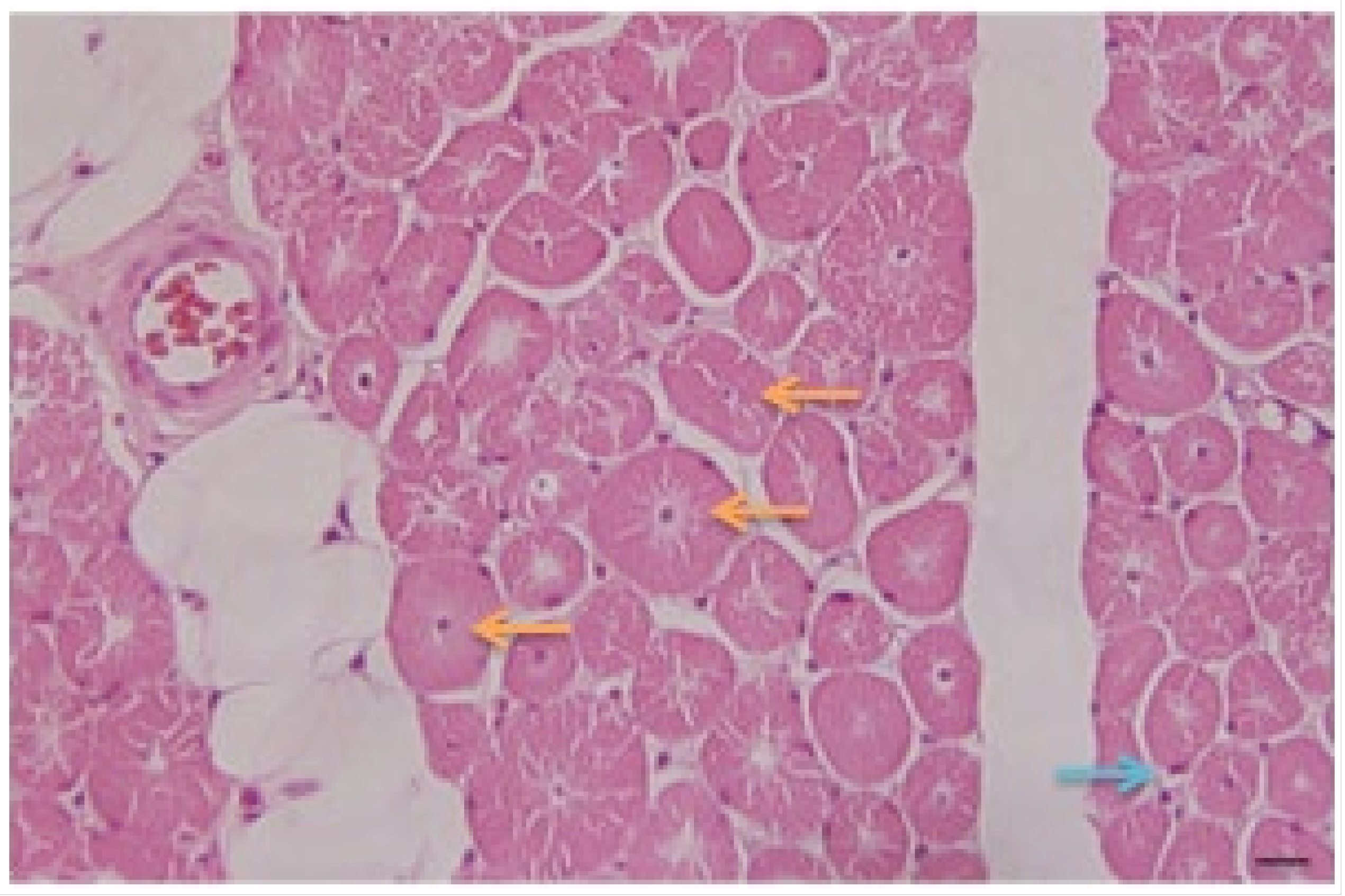 Medicina 59 01112 g003 Medicina 59 01112 g003