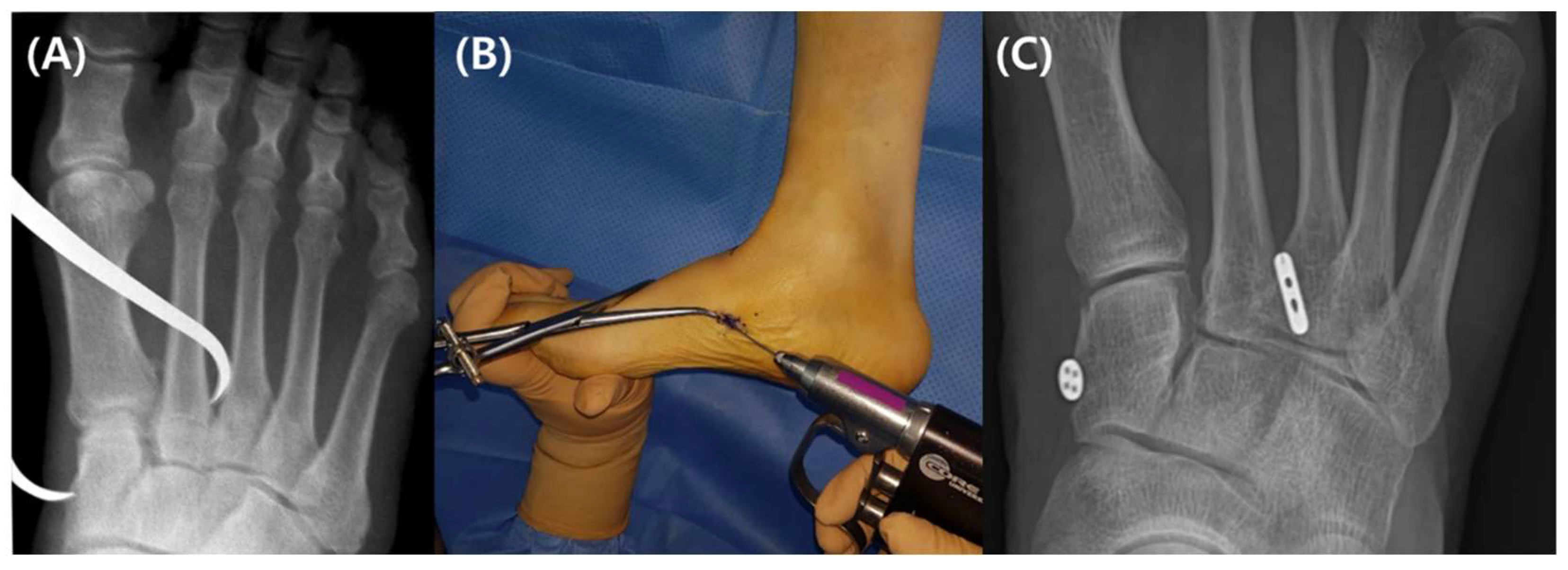 Medicina 59 01134 g004 Medicina 59 01134 g004
