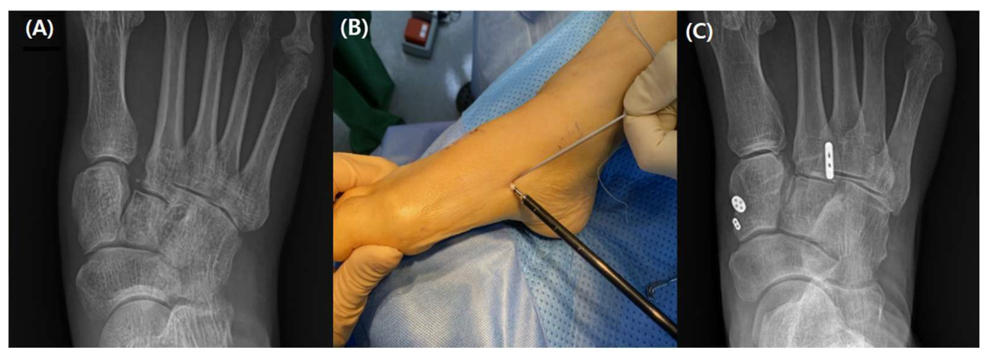 Medicina 59 01134 g006 Medicina 59 01134 g006