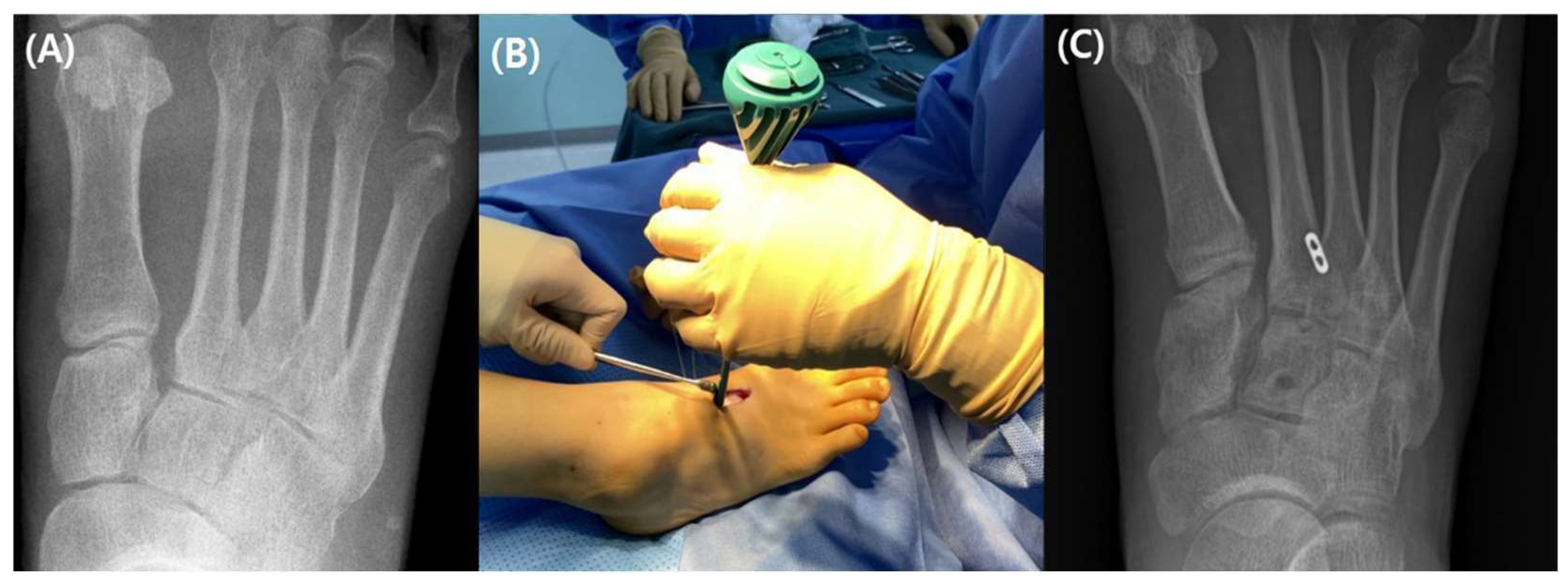 Medicina 59 01134 g007 Medicina 59 01134 g007