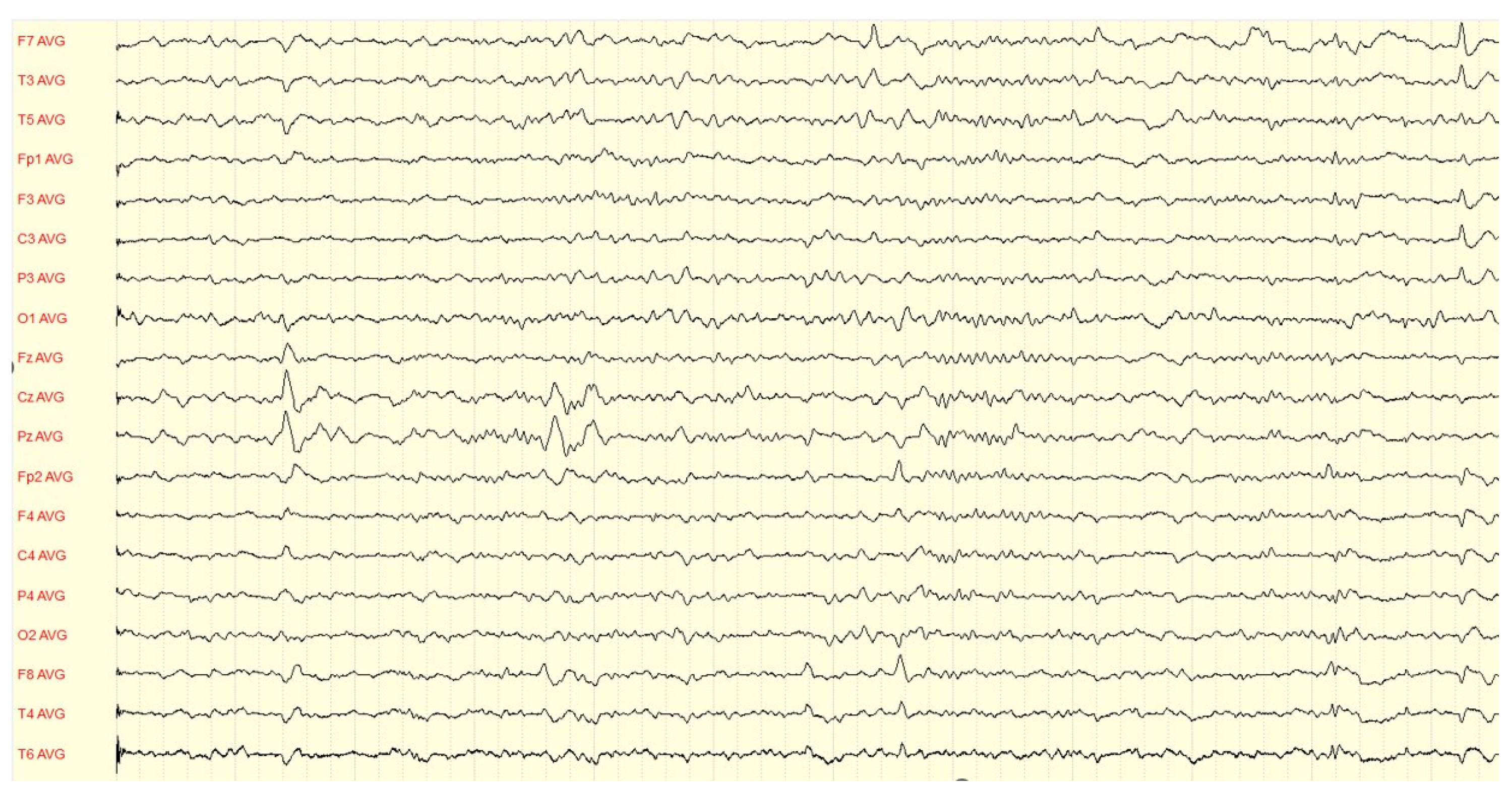 Medicina 59 01135 g004