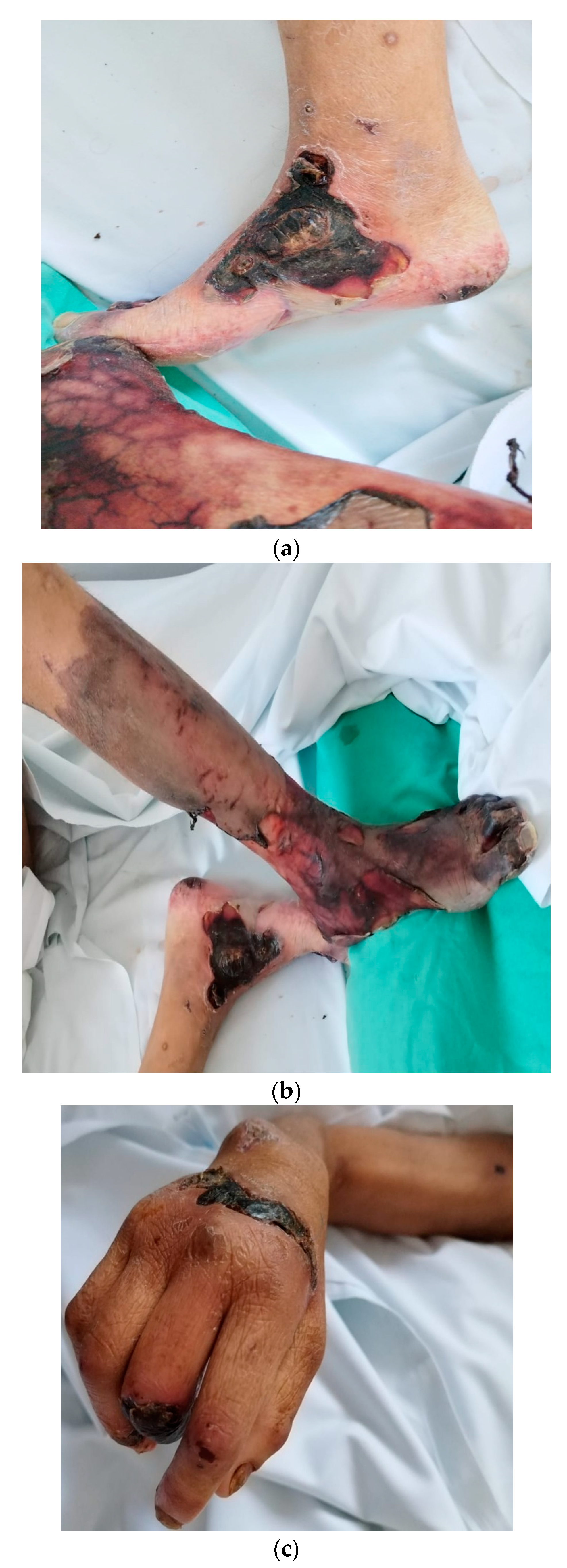 Medicina 59 01162 g005a