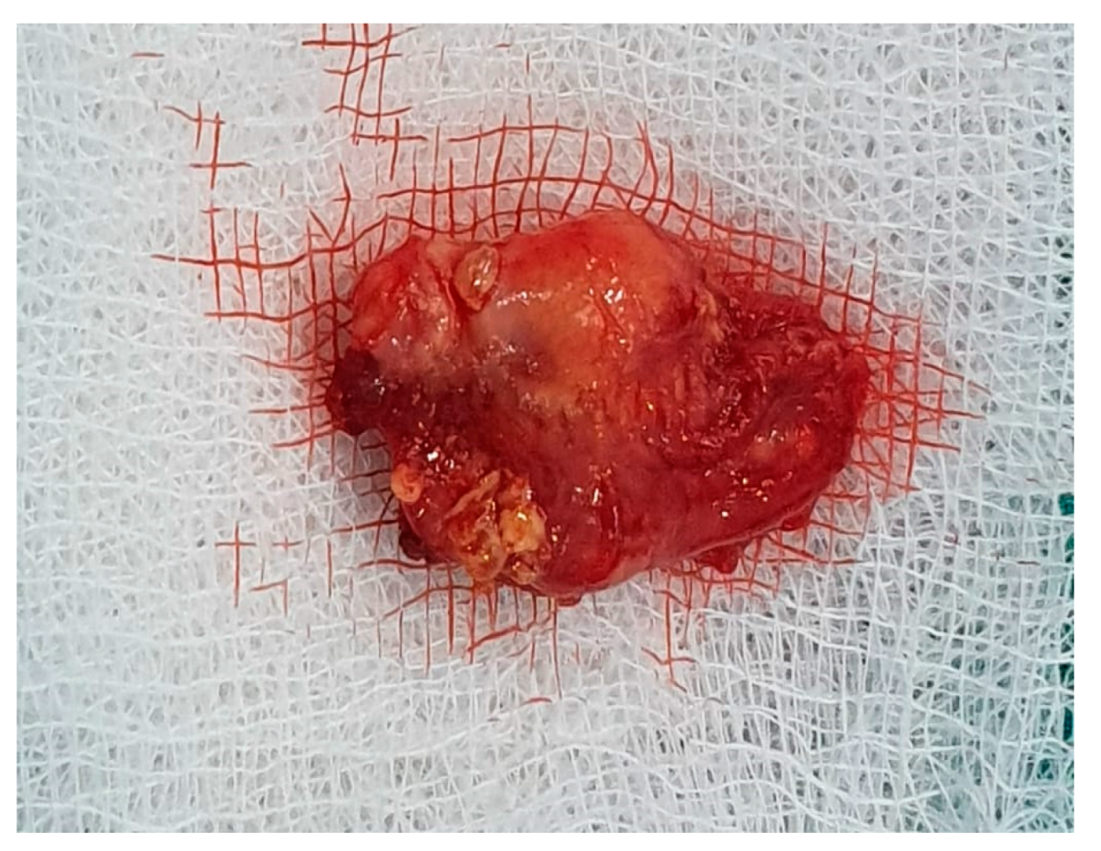 Medicina 59 01167 g013 Medicina 59 01167 g013