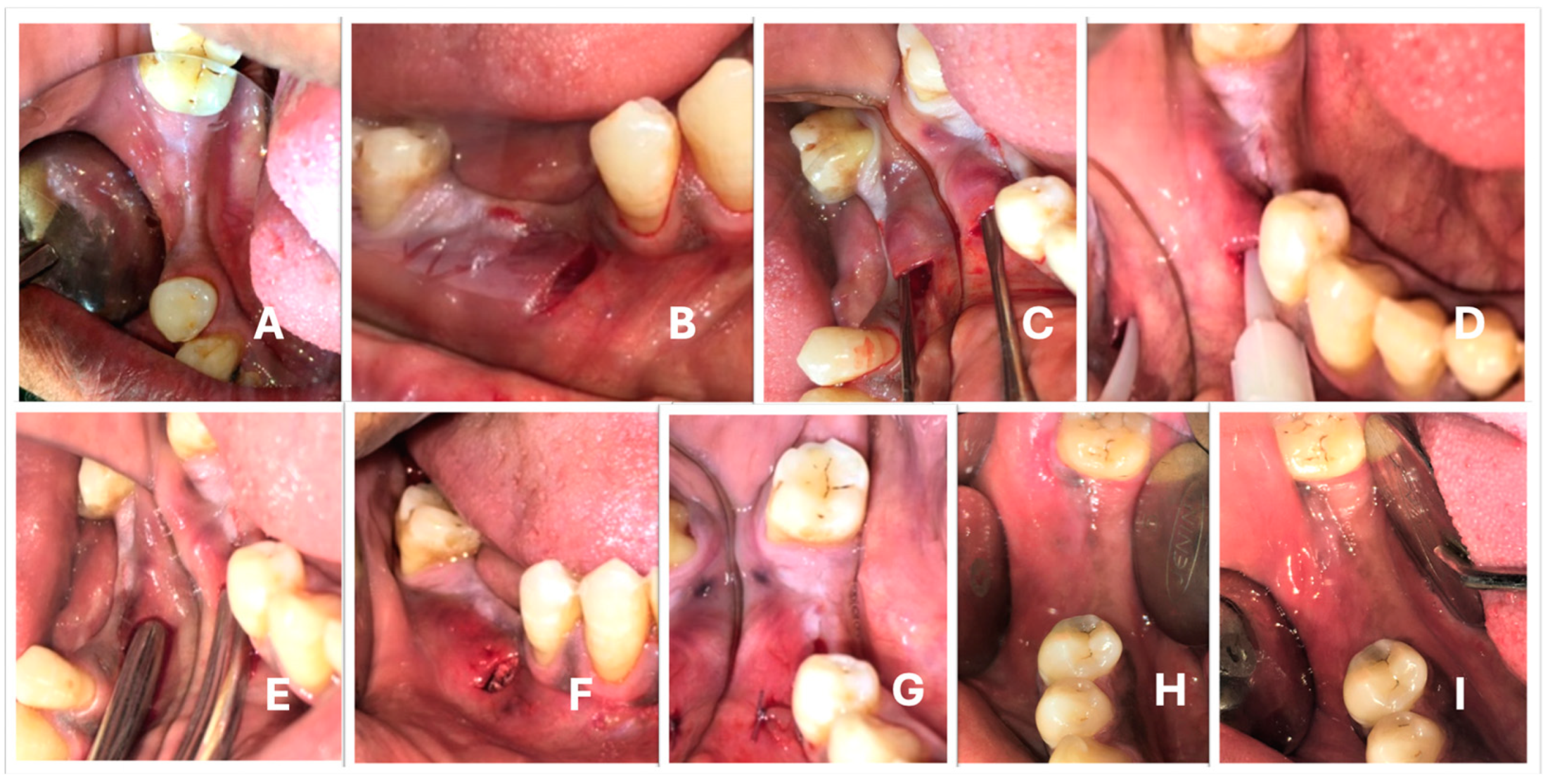 Medicina 59 01178 g002