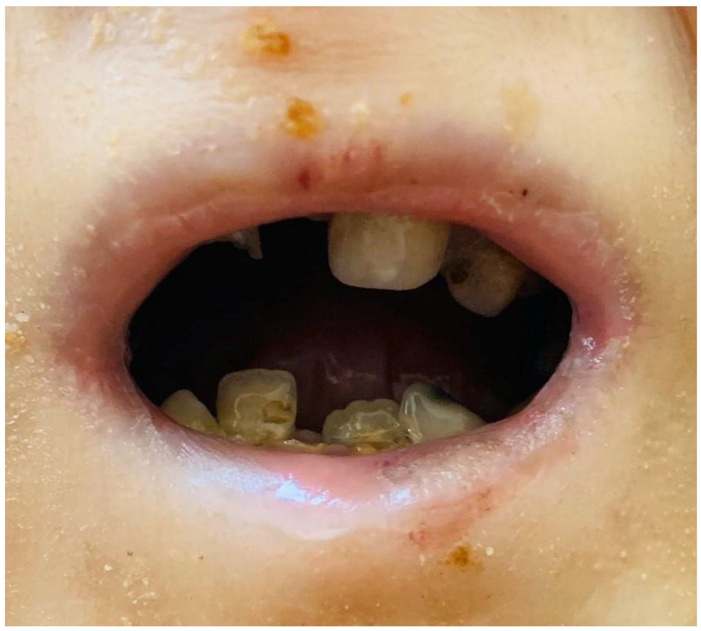 Medicina 59 01185 g004