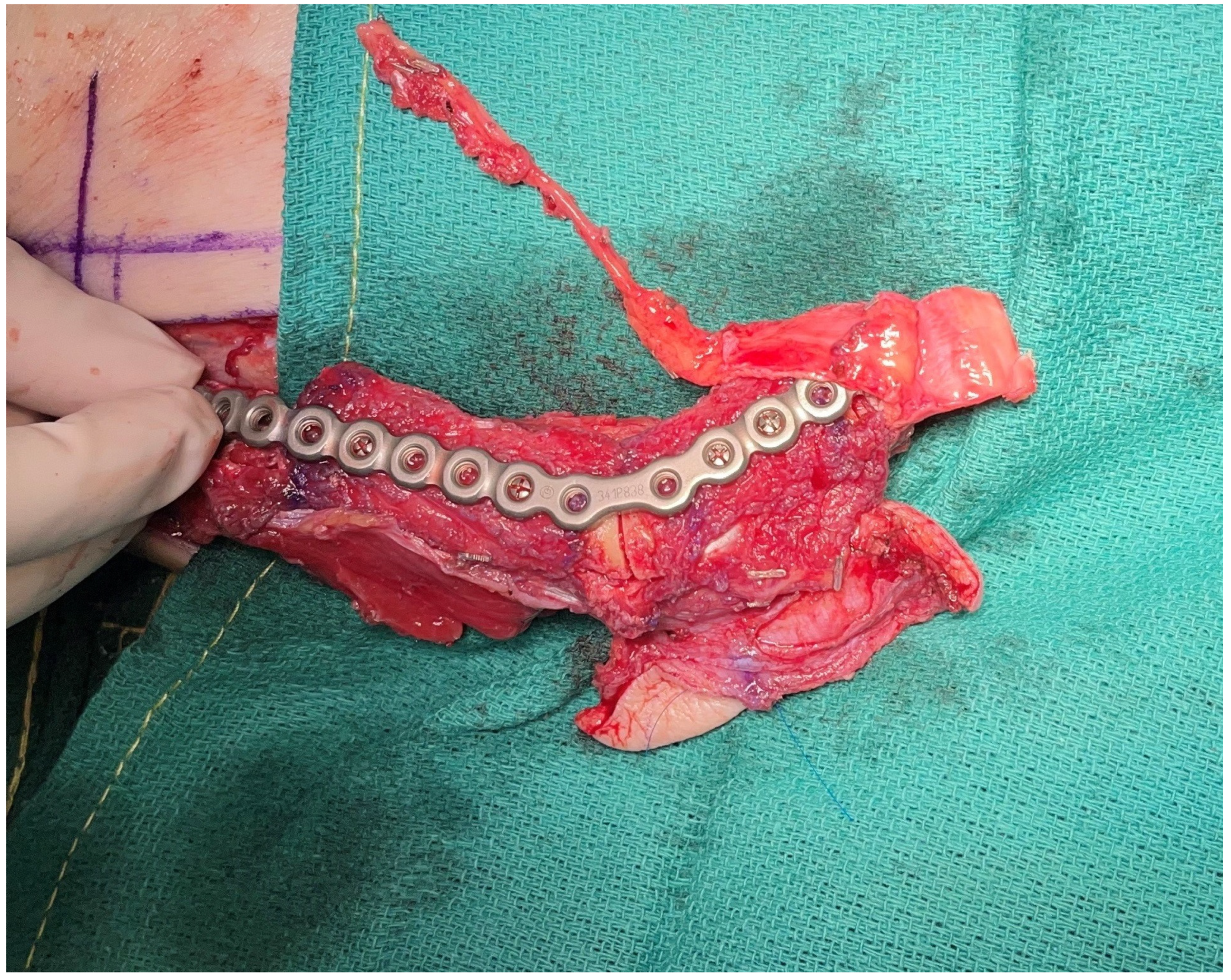 Medicina 59 01194 g002 Medicina 59 01194 g002