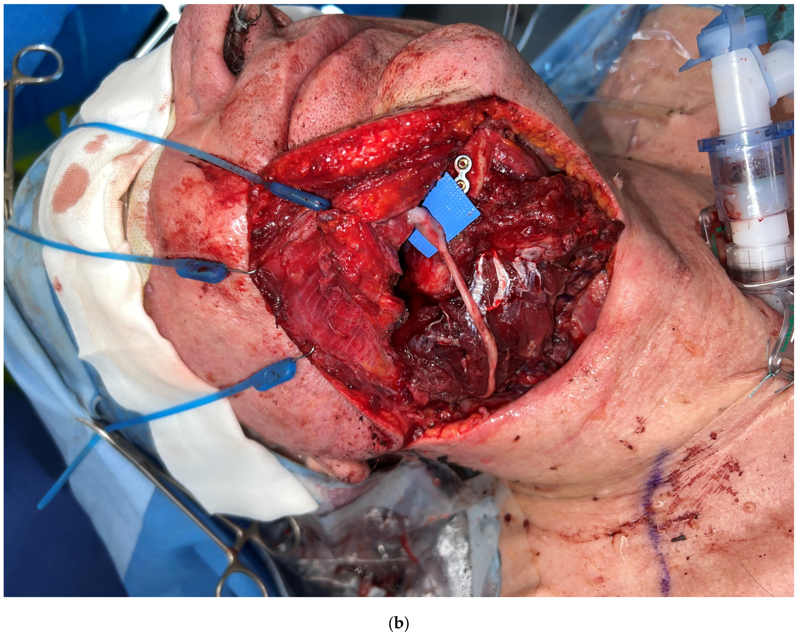 Medicina 59 01194 g003b Medicina 59 01194 g003b