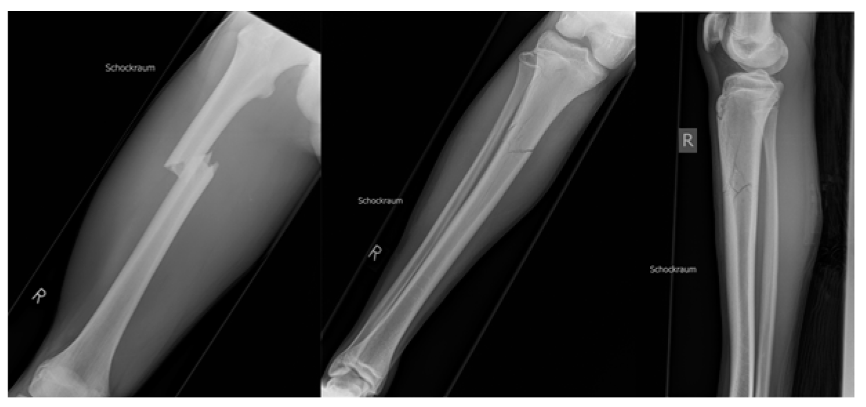 Medicina 59 01206 g002 Medicina 59 01206 g002