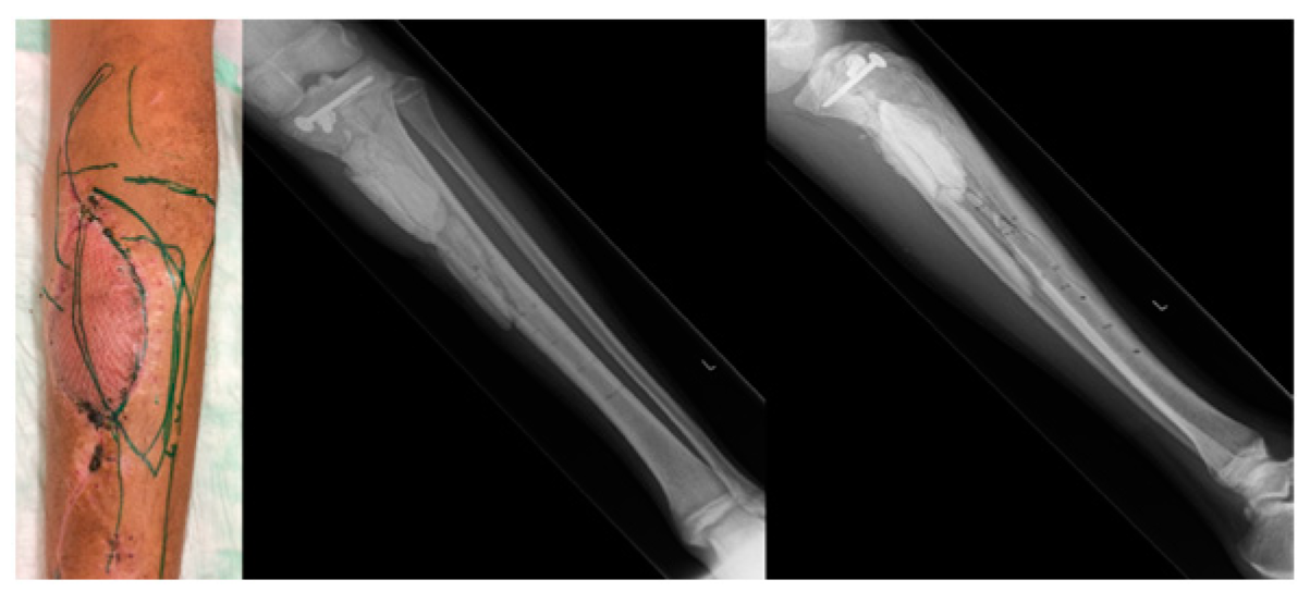 Medicina 59 01206 g003 Medicina 59 01206 g003