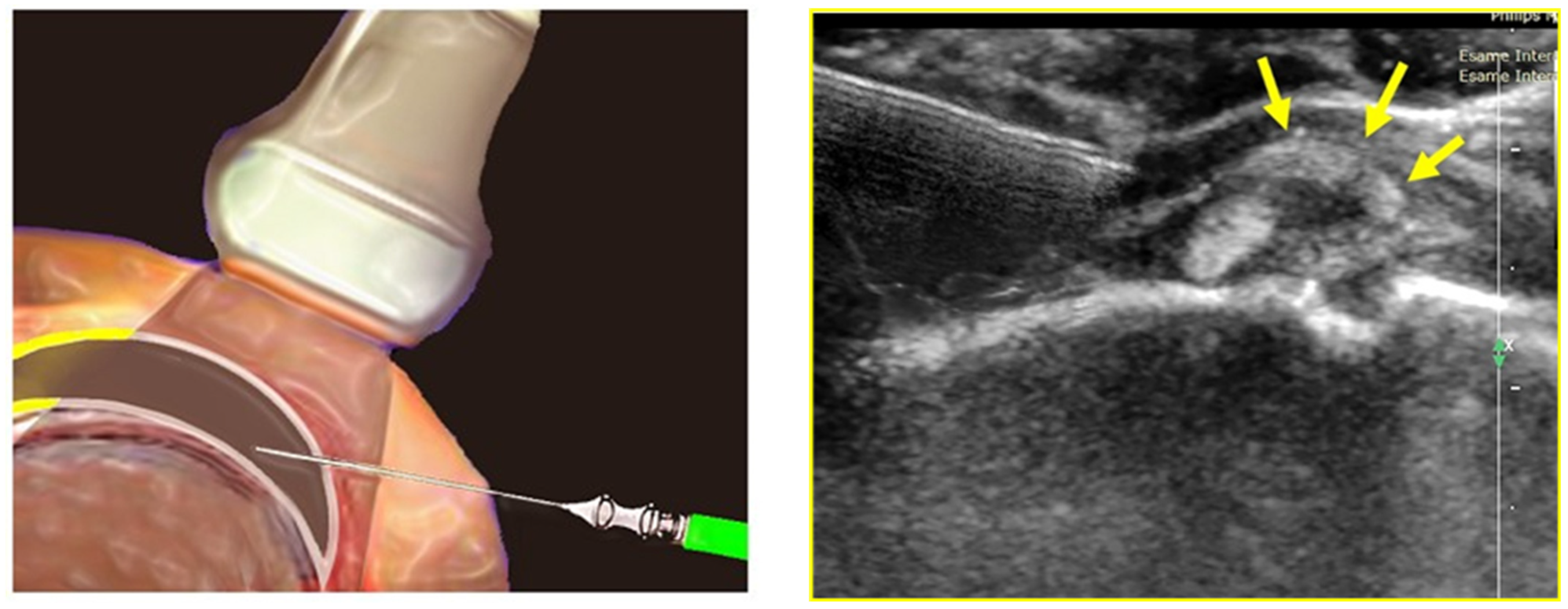 Medicina 59 01211 g003 Medicina 59 01211 g003