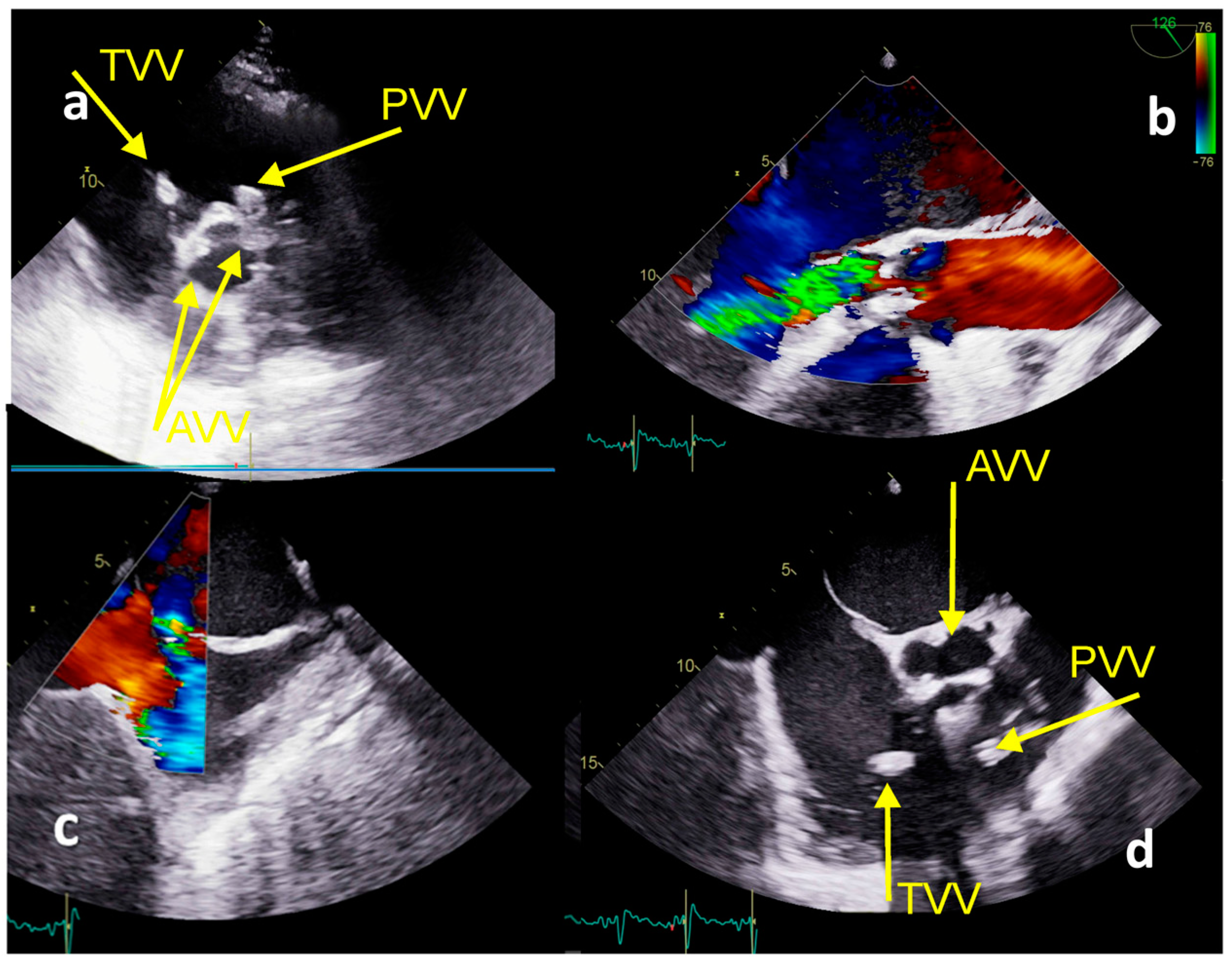 Medicina 59 01213 g005