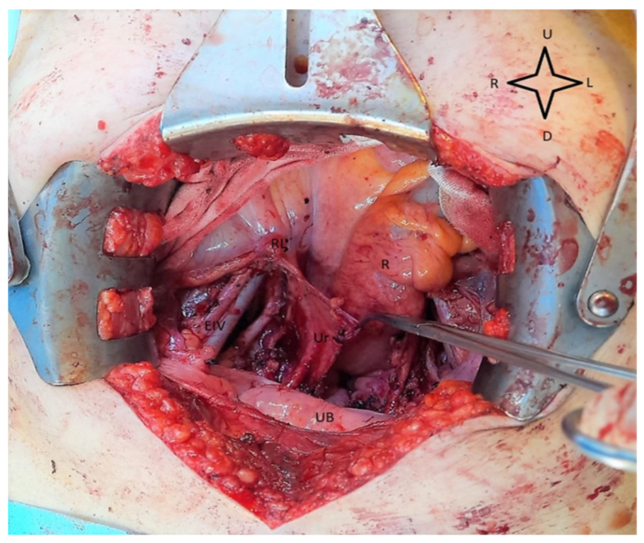 Medicina 59 01229 g003 Medicina 59 01229 g003