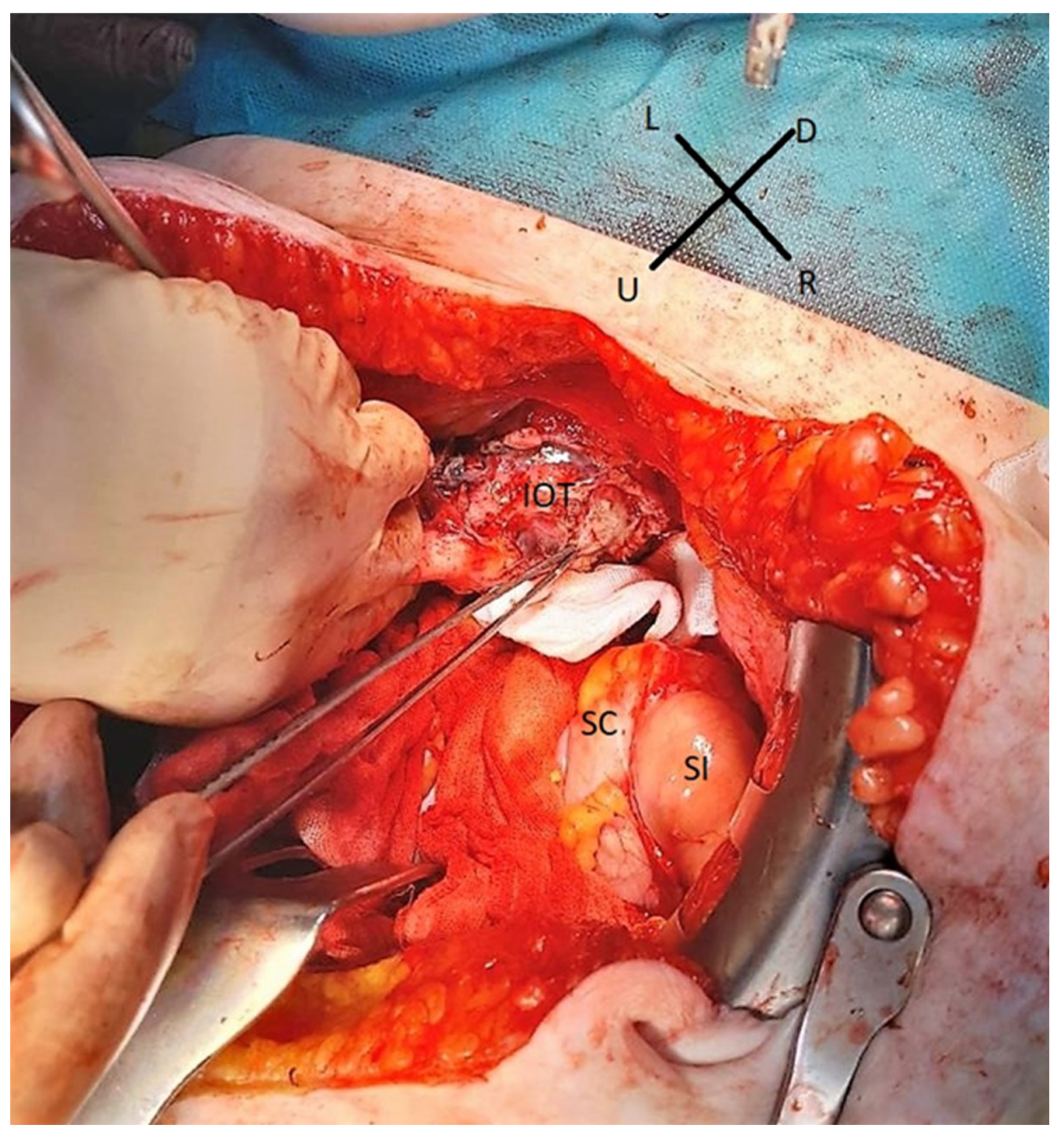 Medicina 59 01229 g004 Medicina 59 01229 g004