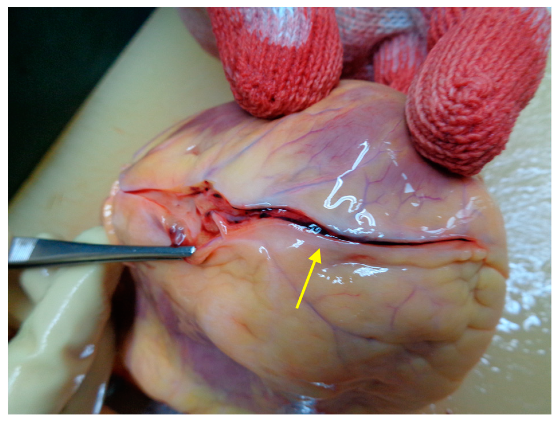 Medicina 59 01257 g003 Medicina 59 01257 g003