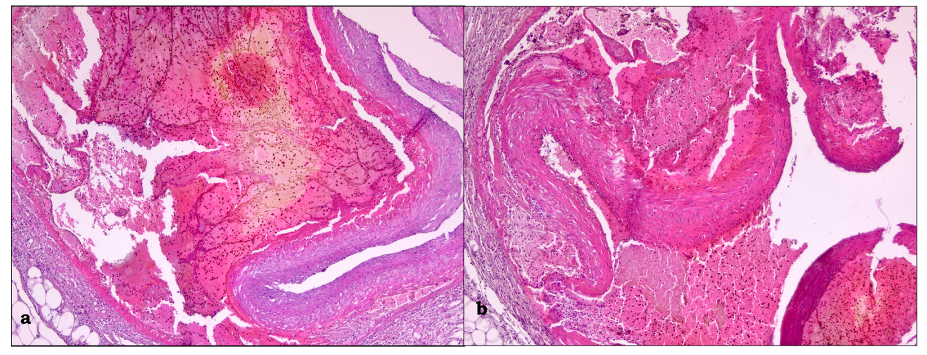 Medicina 59 01257 g005 Medicina 59 01257 g005