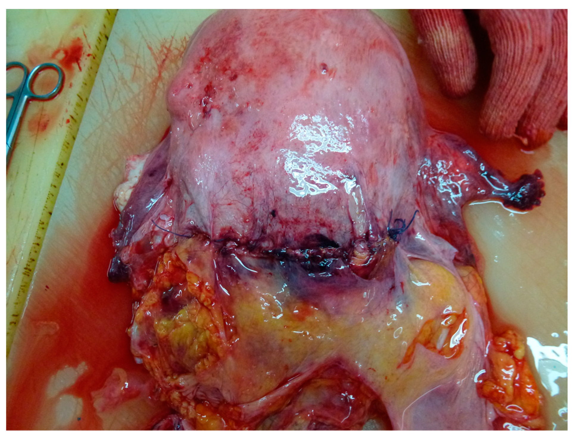 Medicina 59 01257 g006 Medicina 59 01257 g006