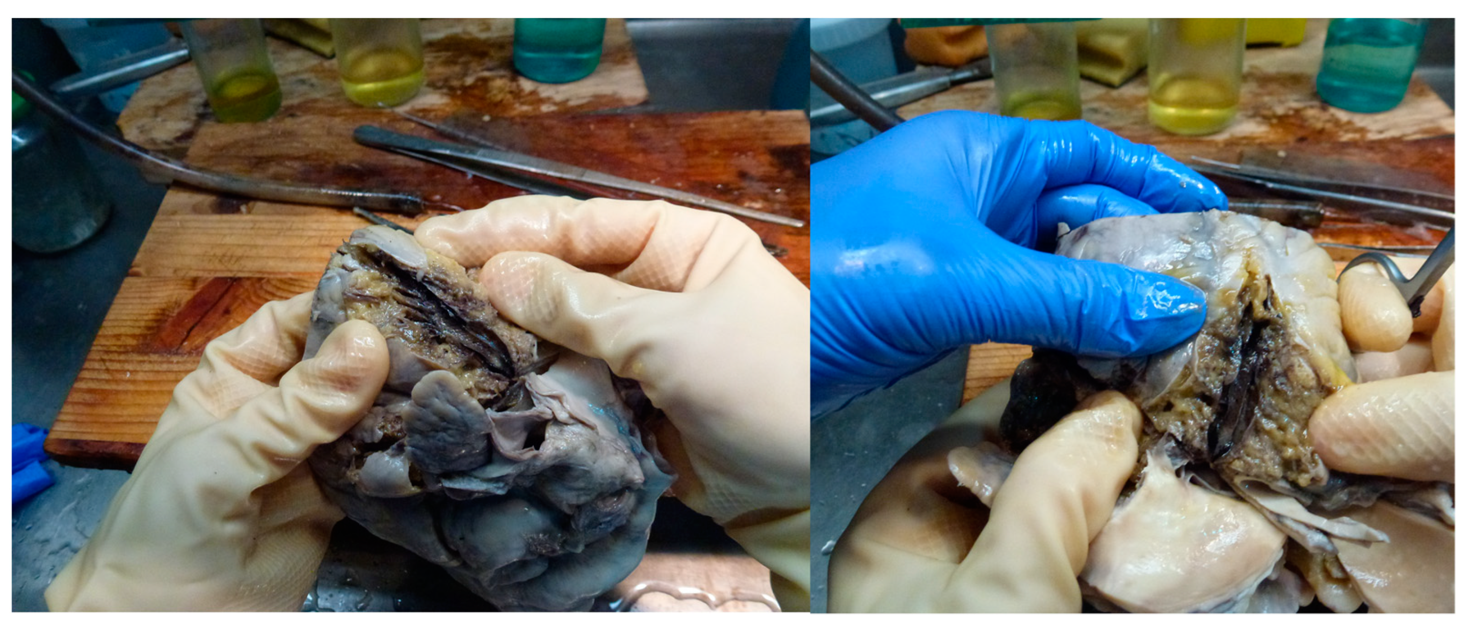 Medicina 59 01257 g008 Medicina 59 01257 g008