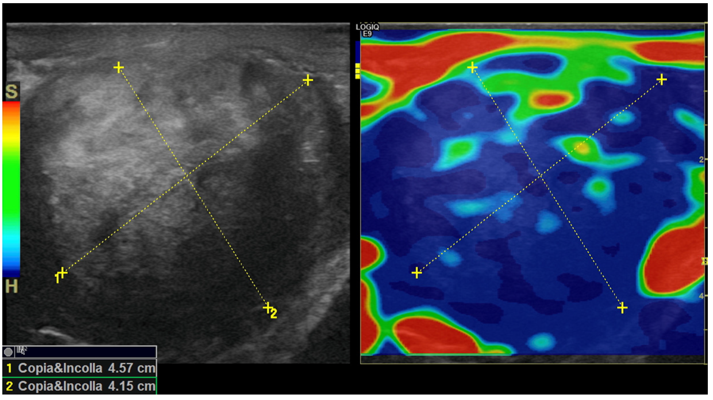 Medicina 59 01261 g005