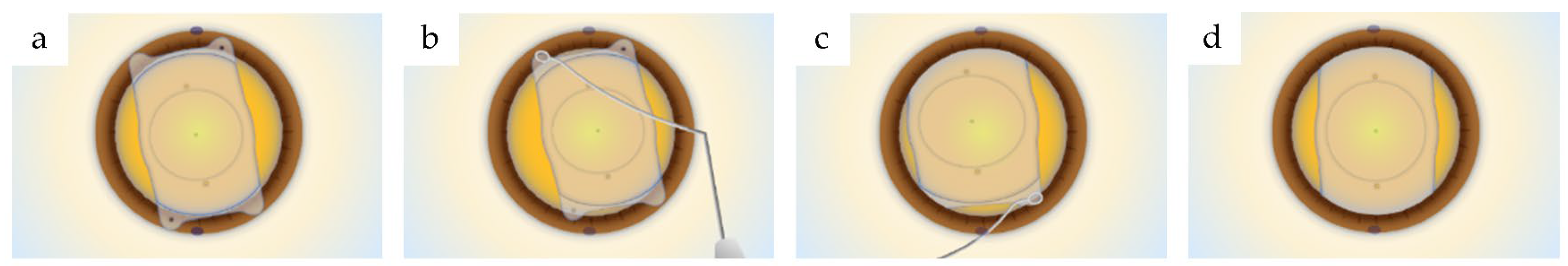 Medicina 59 01282 g001 Medicina 59 01282 g001