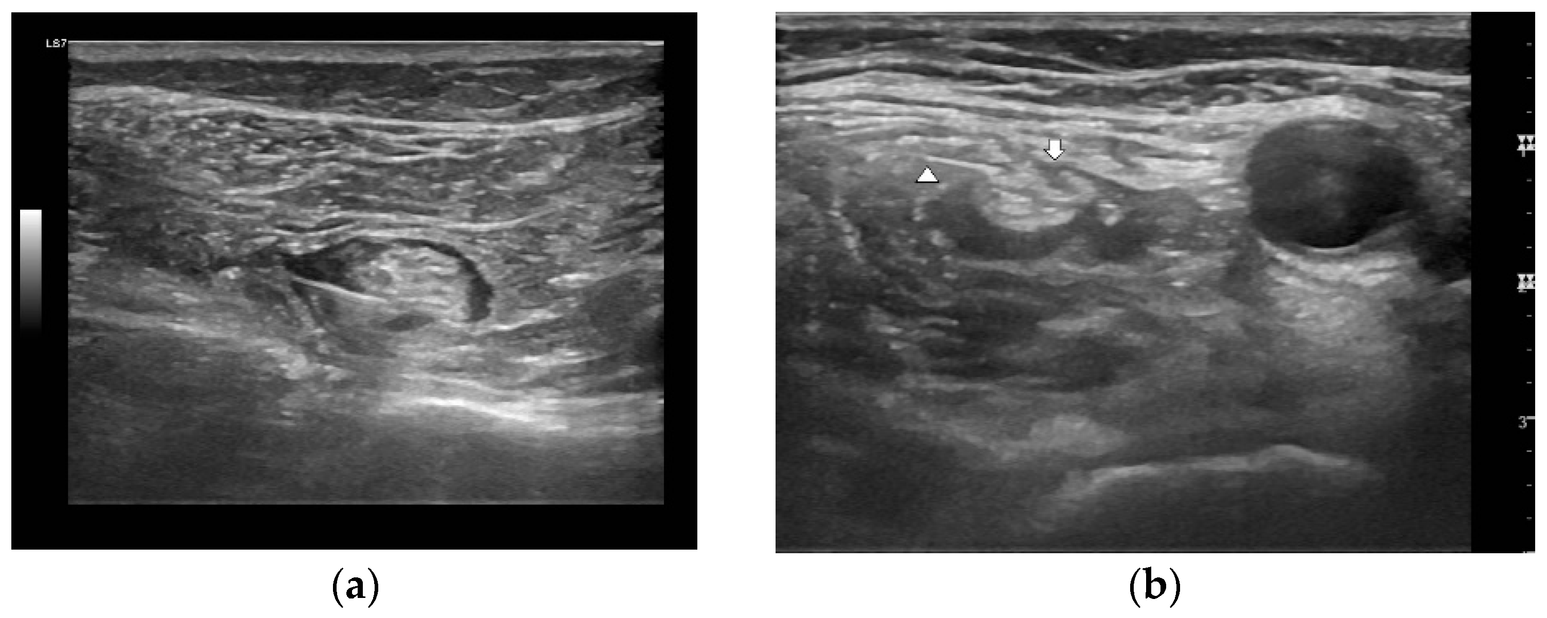 Medicina 59 01302 g004 Medicina 59 01302 g004