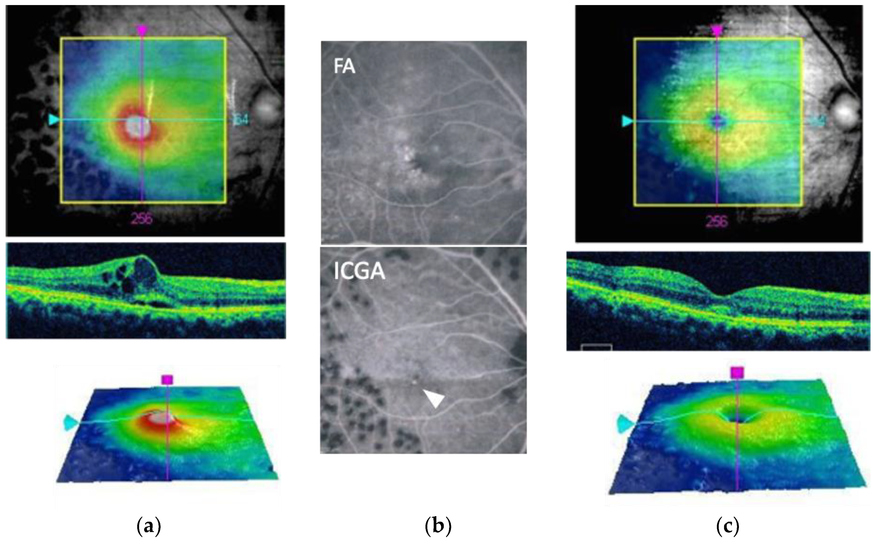 Medicina 59 01319 g003 Medicina 59 01319 g003