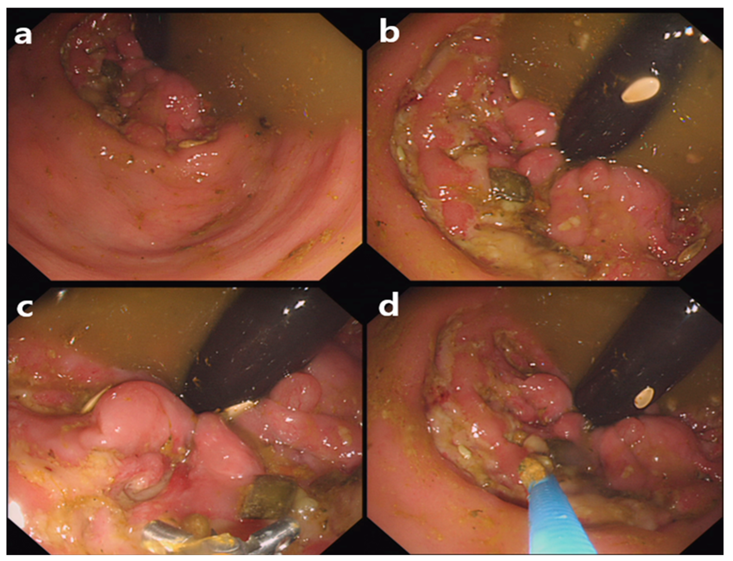 Medicina 59 01331 g005