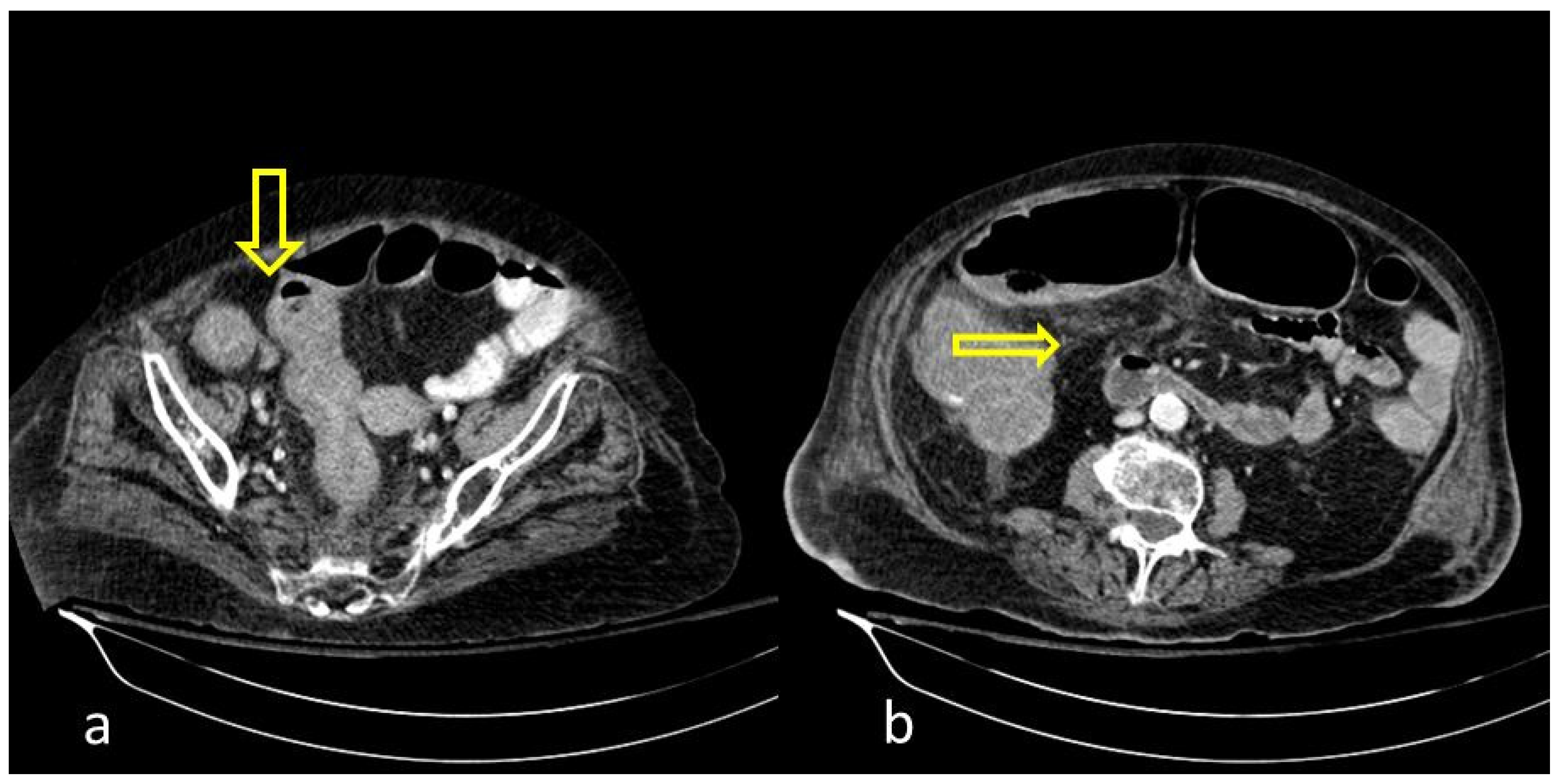 Medicina 59 01332 g001