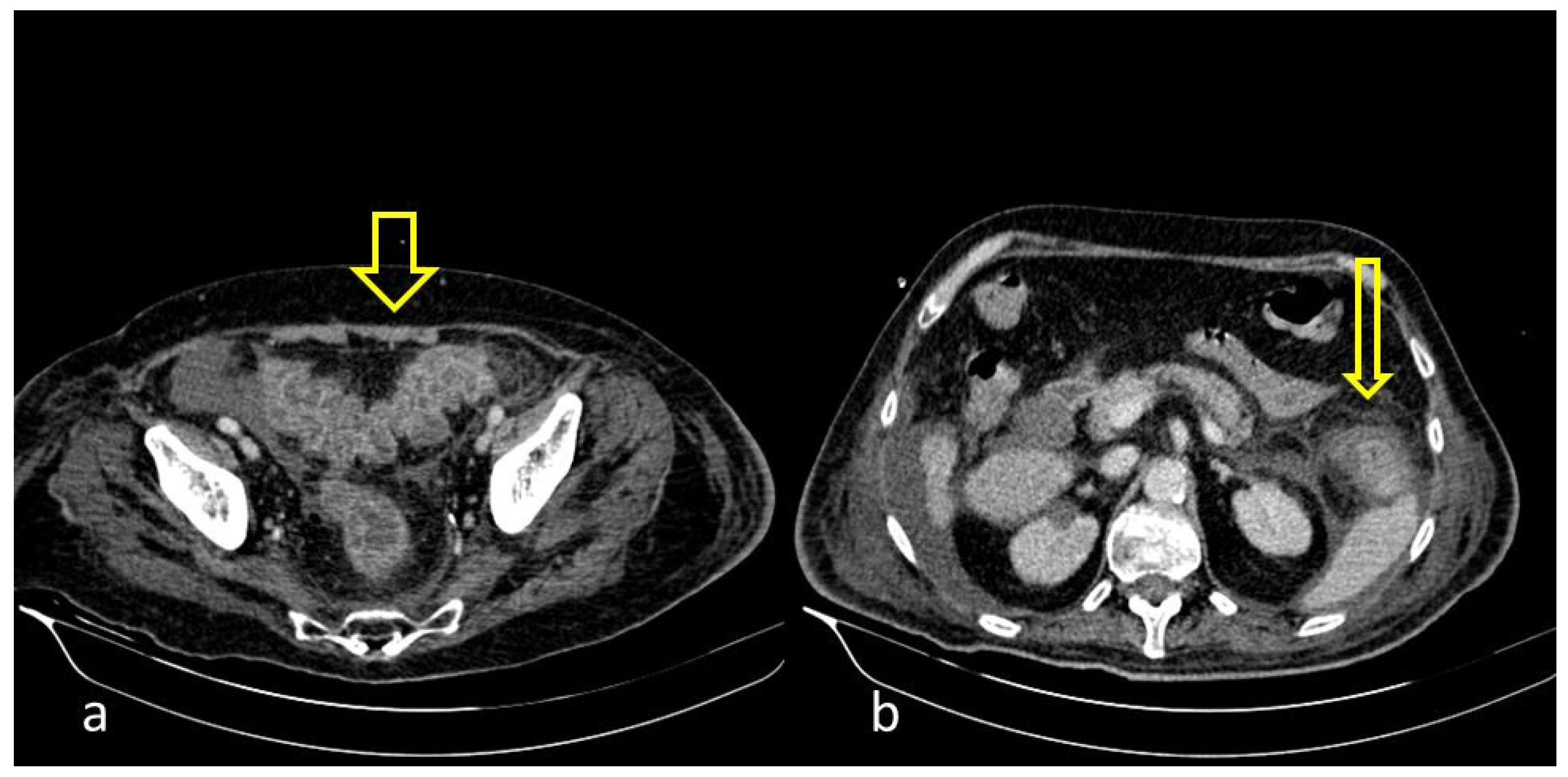 Medicina 59 01332 g002