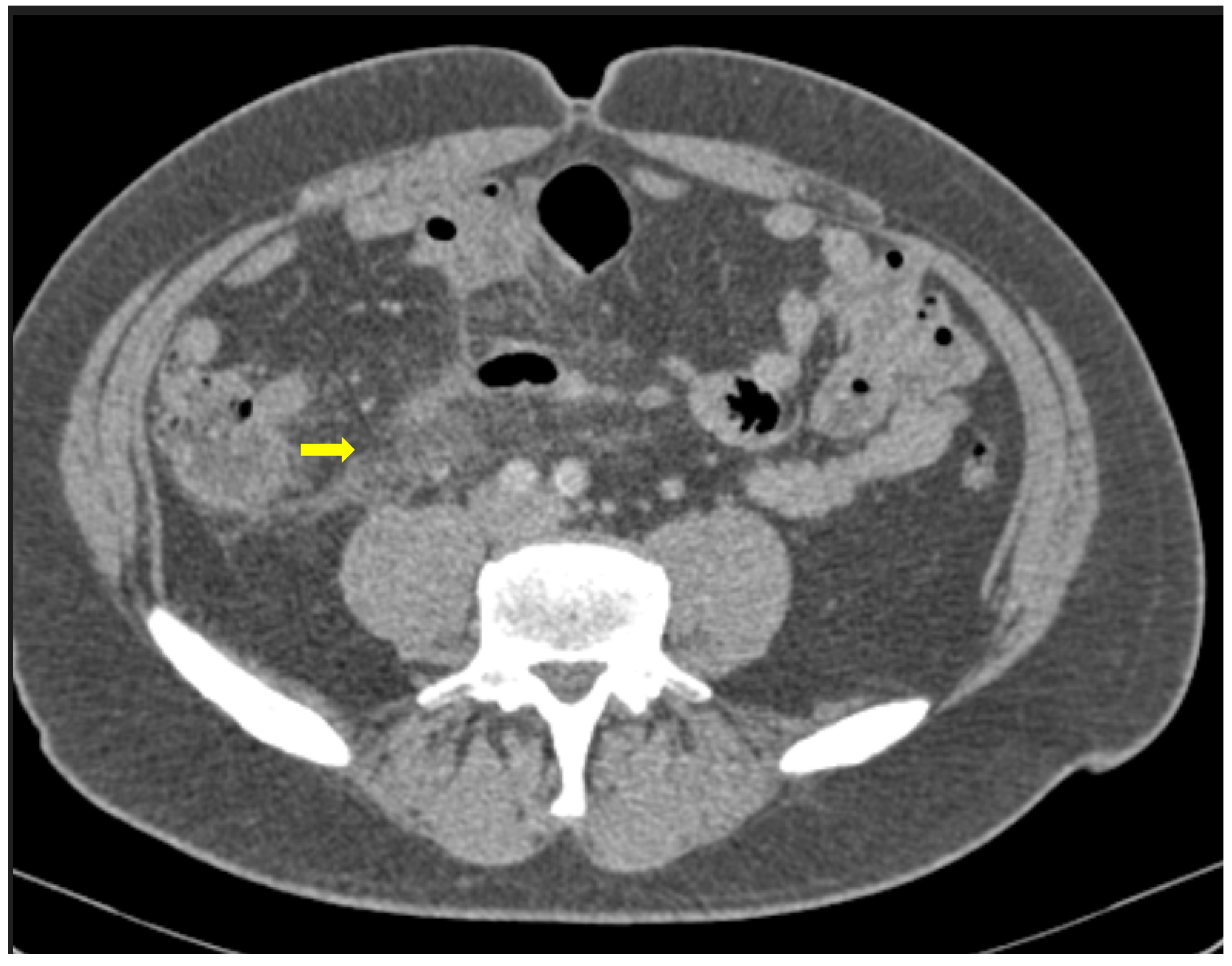 Medicina 59 01332 g003
