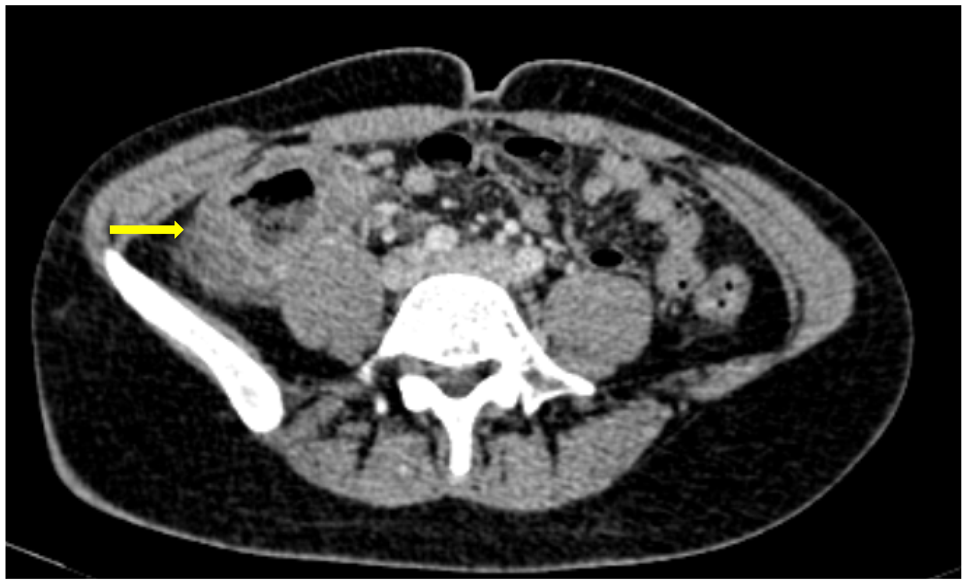 Medicina 59 01332 g004