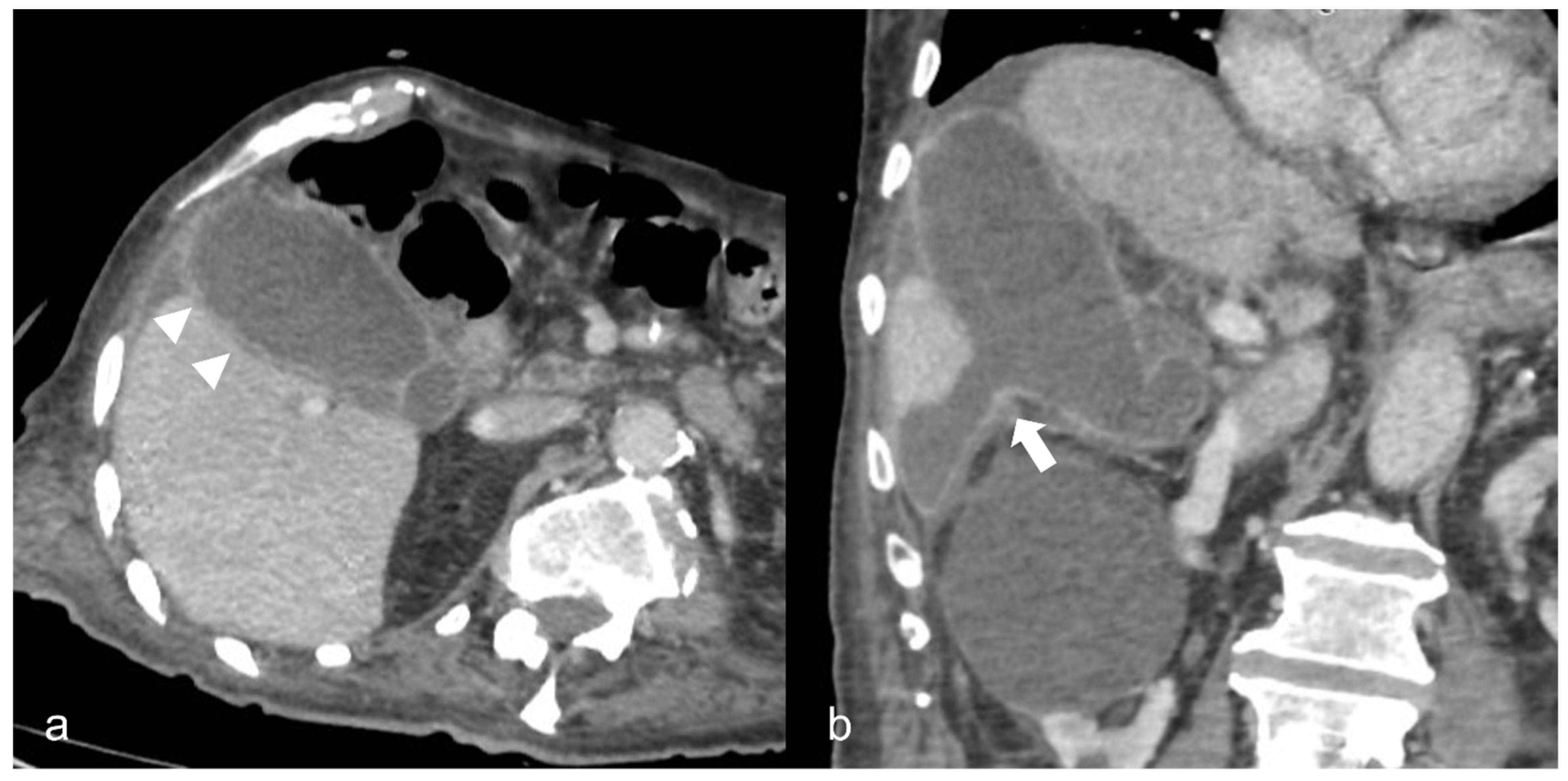 Medicina 59 01332 g008