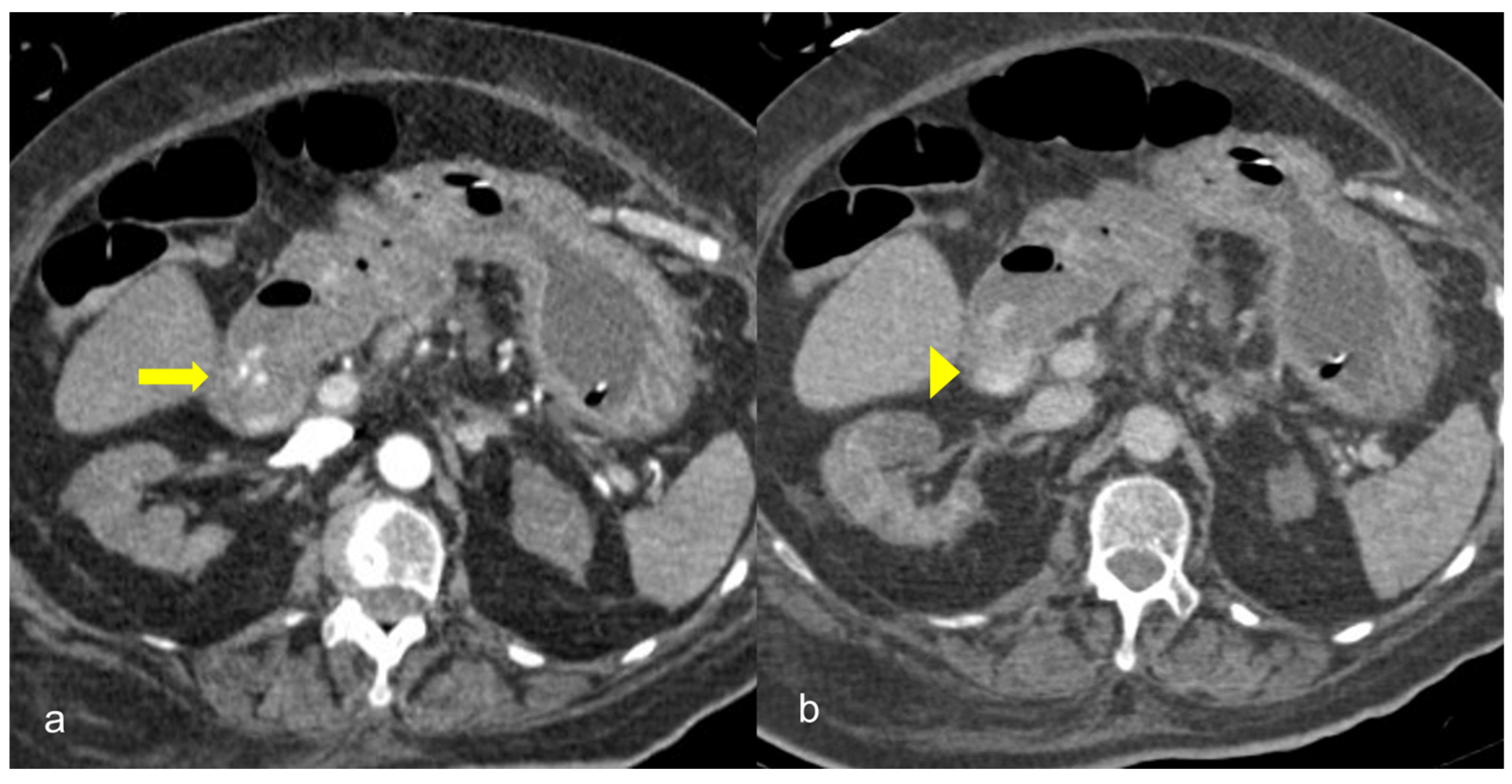 Medicina 59 01332 g011