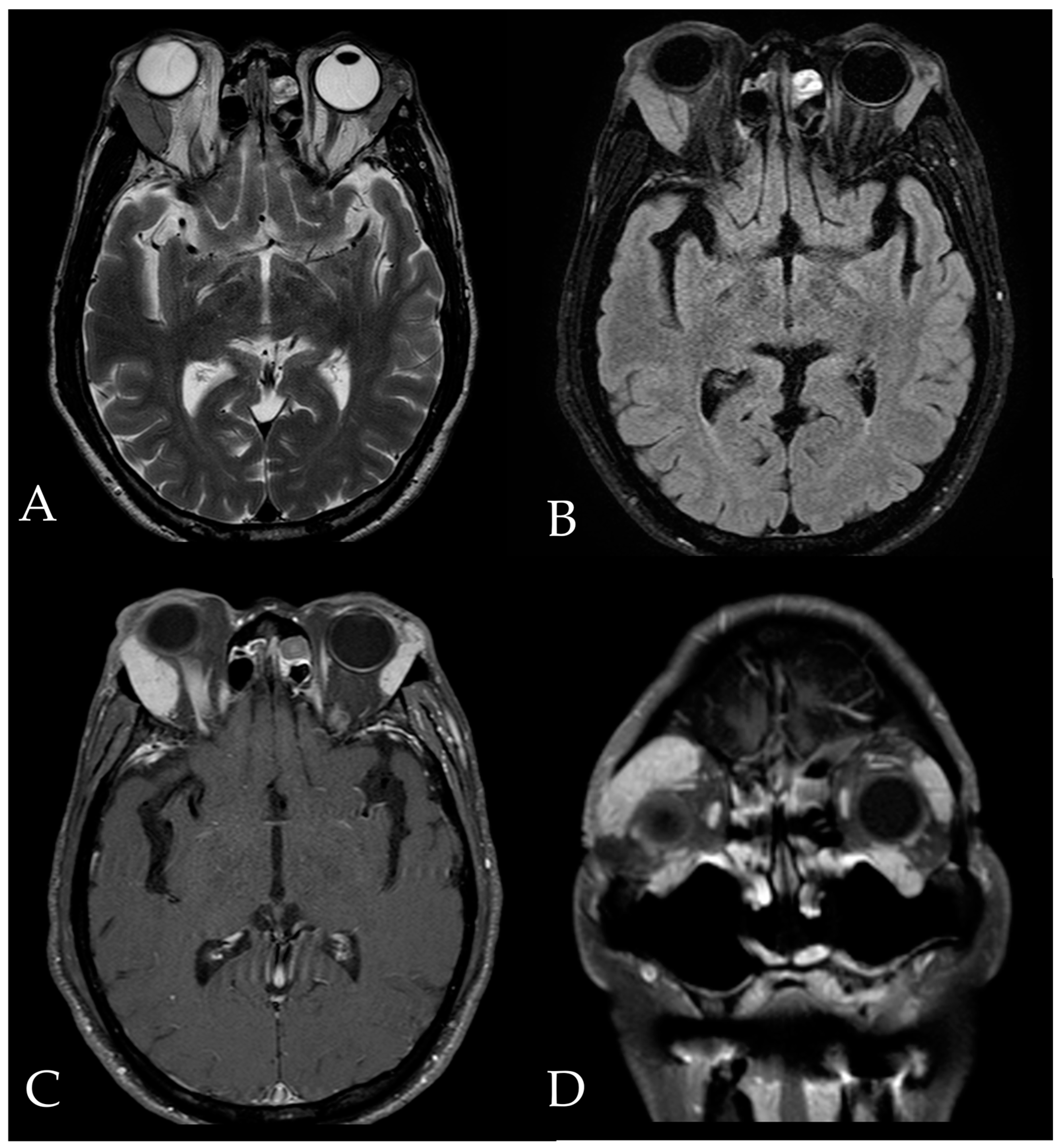Medicina 59 01381 g002