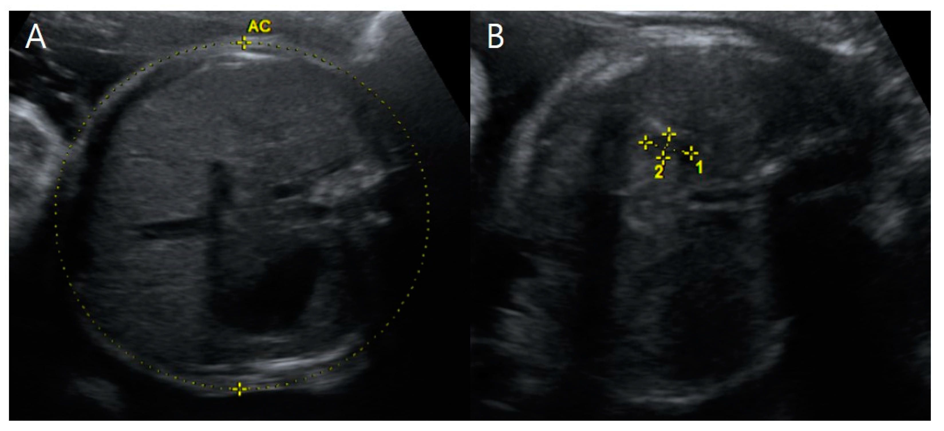 Medicina 59 01387 g006