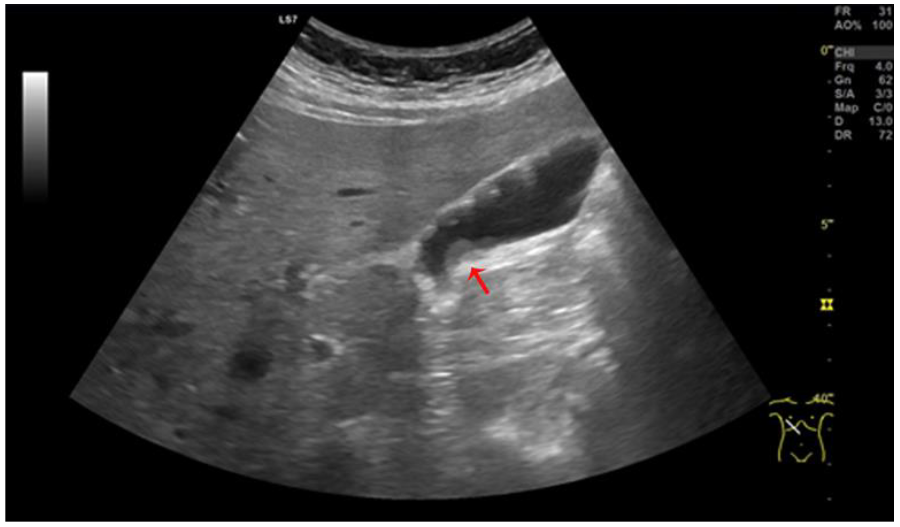 Medicina 59 01407 g002 Medicina 59 01407 g002