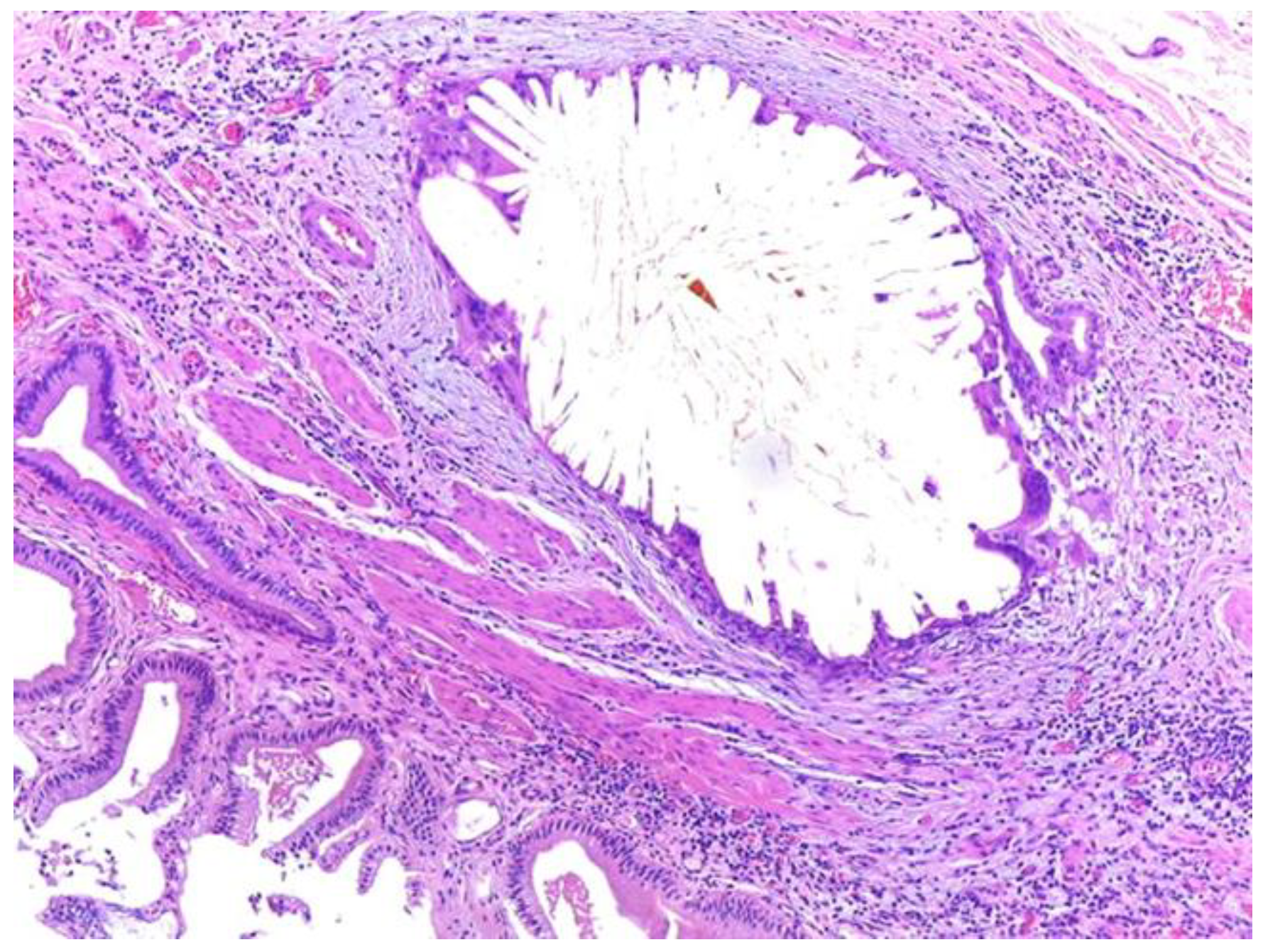 Medicina 59 01407 g008 Medicina 59 01407 g008